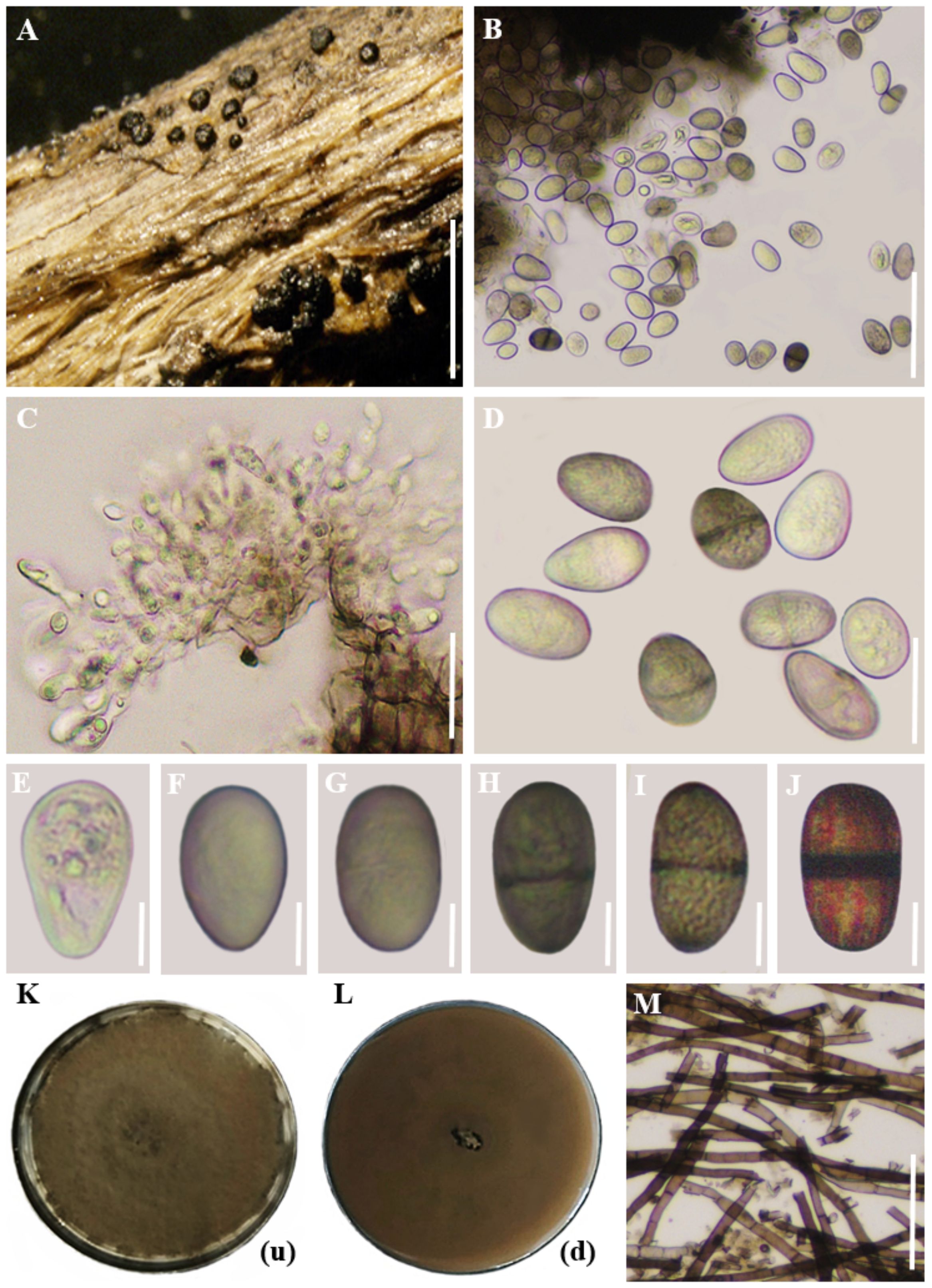 Panel A shows dark fungal structures on wood. Panel B displays microscopic oval spores. Panel C illustrates a cluster of spores. Panel D presents close-up of spores. Panels E to J depict individual spores with variations in texture and color. Panels K and L are petri dishes with mold growth labeled as “u” and “d.” Panel M contains thin, elongated structures under magnification.