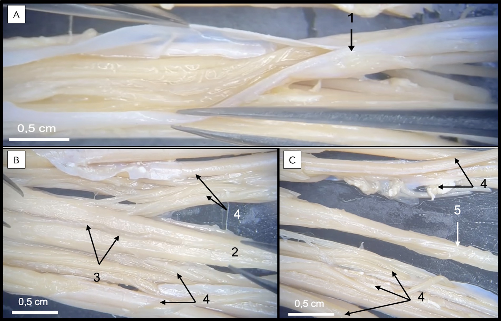 Three dissection panels of a canine specimen viewed ventrally. Panel A shows the dural sac with the dura incised. Panel B shows the exposed filum terminale internum with associated arteries and nerve roots. Panel C highlights the filum terminale externum beyond the dural sac.