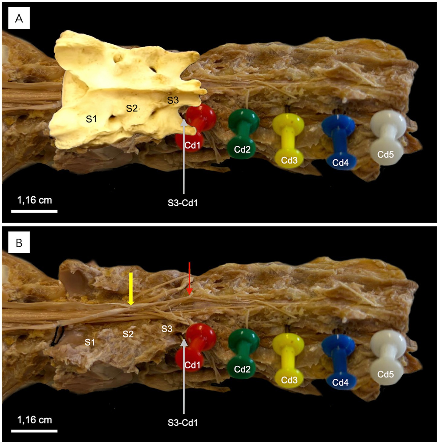 Dorsolateral dissection images of sacral and caudal vertebrae. Panel A includes vertebral labels with needles marking Cd1–Cd5. Panel B shows the sacrum removed, with arrows indicating the dural sac termination and filum terminale externum attachment to the Cd1–Cd2 interarcuate ligament.