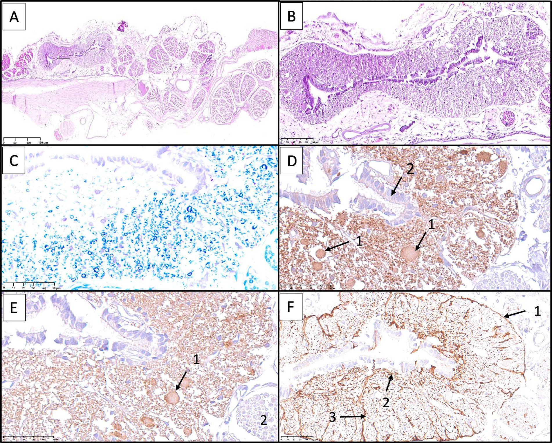 Histological and immunohistochemical images of the filum terminale internum. Panels show H&E and Kluver-Barrera stains, and immunolabeling for NSE, PGP 9.5, and GFAP, highlighting neurons, glial cells, myelin, and astrocytic processes.