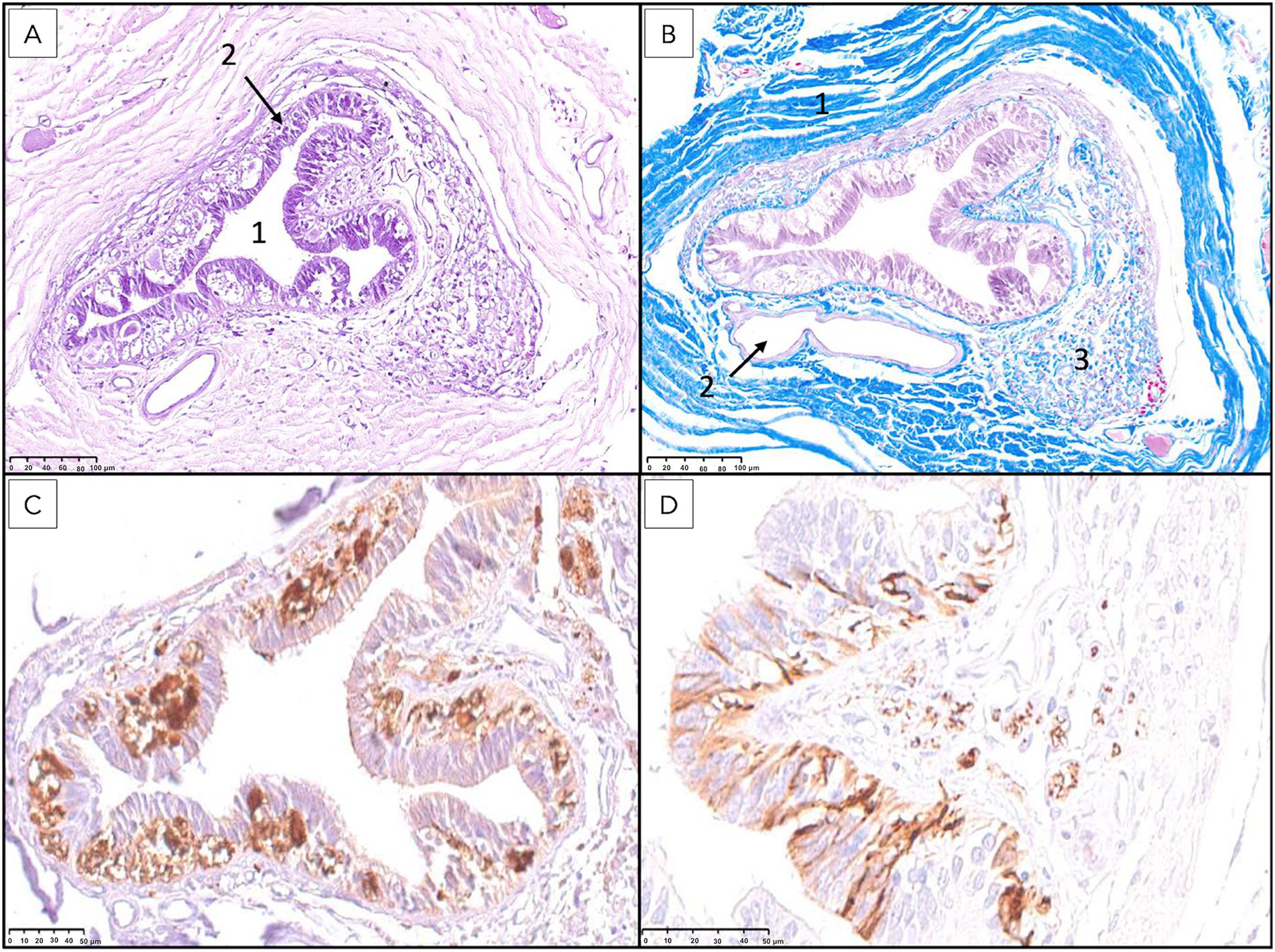 Histological and immunohistochemical images of the filum terminale externum at the S3 level. H&E and Masson’s trichrome reveal central canal, dura mater, blood vessels, and connective tissue. Immunolabeling (PGP 9.5, GFAP) shows neurons and astrocytic processes.