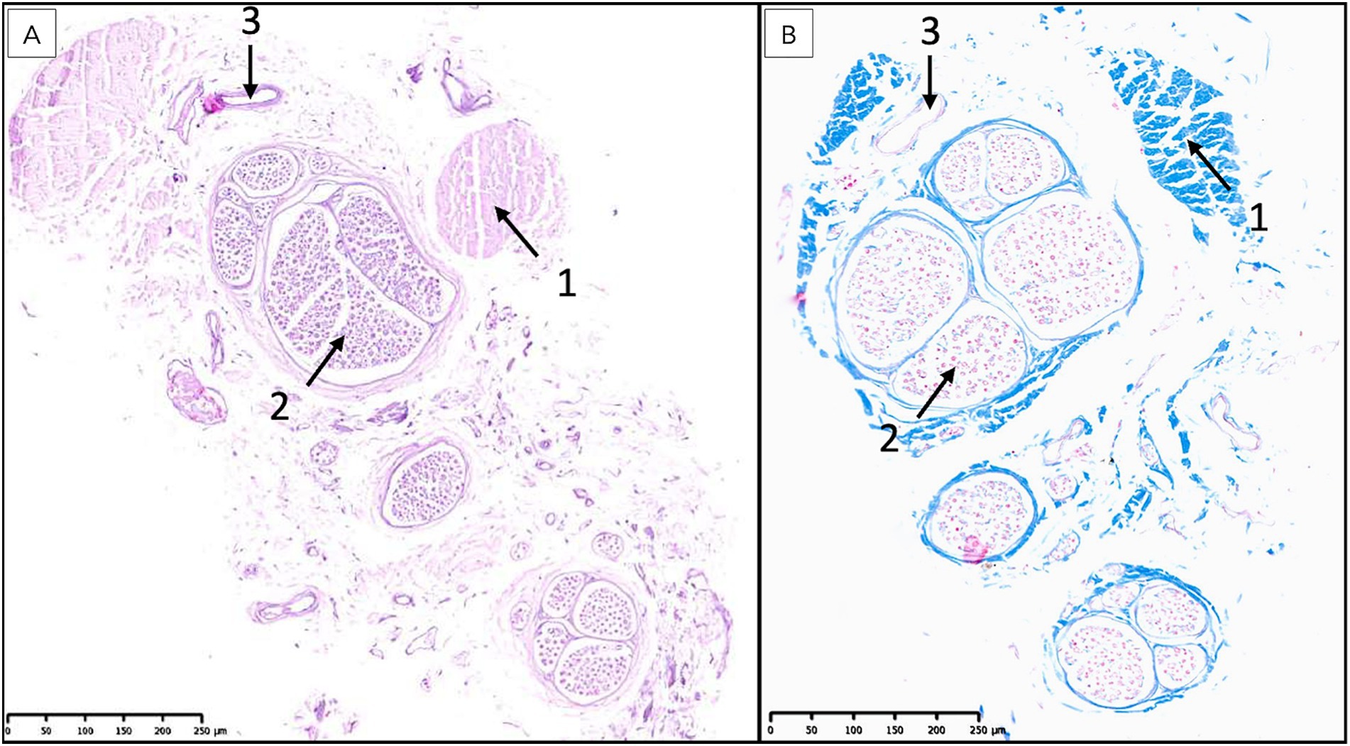 Histological sections of the terminal filum terminale externum at the Cd1 level. H&E and Masson’s trichrome stains show dense collagen bands, scattered nerve fibers, and blood vessels, with no central canal, consistent with its fibrous nature.