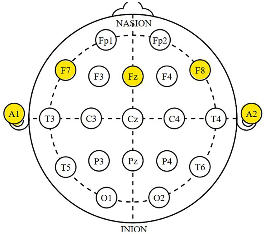 Diagram of a head with labeled electrode positions used for EEG. Circles with labels A1, F7, Fz, F8, and A2 are highlighted in yellow, indicating specific electrode sites. Lines connect these points in a standardized layout.