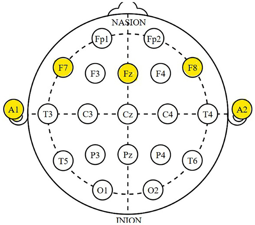 Diagram of a head with labeled electrode positions used for EEG. Circles with labels A1, F7, Fz, F8, and A2 are highlighted in yellow, indicating specific electrode sites. Lines connect these points in a standardized layout.