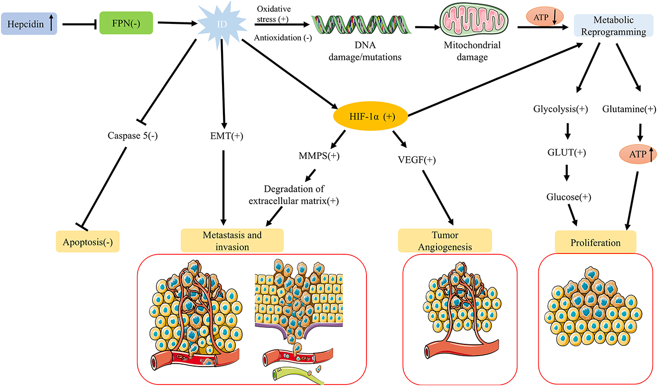 Flowchart illustrating the biological pathway of tumor progression influenced by Hepcidin and iron deficiency (ID). Hepcidin upregulation and FPN downregulation lead to oxidative stress, DNA damage, and mitochondrial damage. These activate HIF-1α, enhancing metastasis, invasion, tumor angiogenesis, and proliferation. EMT, MMP, and VEGF involvement is shown. Metabolic reprogramming increases glycolysis, glutamine, GLUT, and ATP, promoting cancer cell proliferation. Diagrams depict the processes of invasion, angiogenesis, and proliferation.