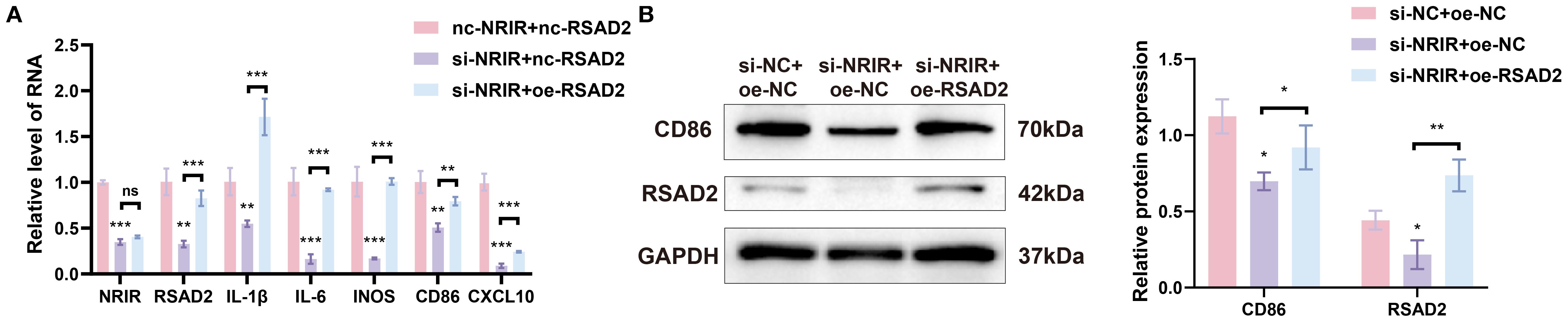 Bar graphs and Western blot images compare RNA and protein expression levels across different conditions. Graph A shows relative RNA levels of NRIR, RSAD2, IL-1β, IL-6, INOS, CD86, and CXCL10, with significant differences indicated by asterisks. Graph B displays protein expression levels of CD86 and RSAD2, showing variations across si-NC+oe-NC, si-NRIR+oe-NC, and si-NRIR+oe-RSAD2 conditions. GAPDH serves as a loading control.