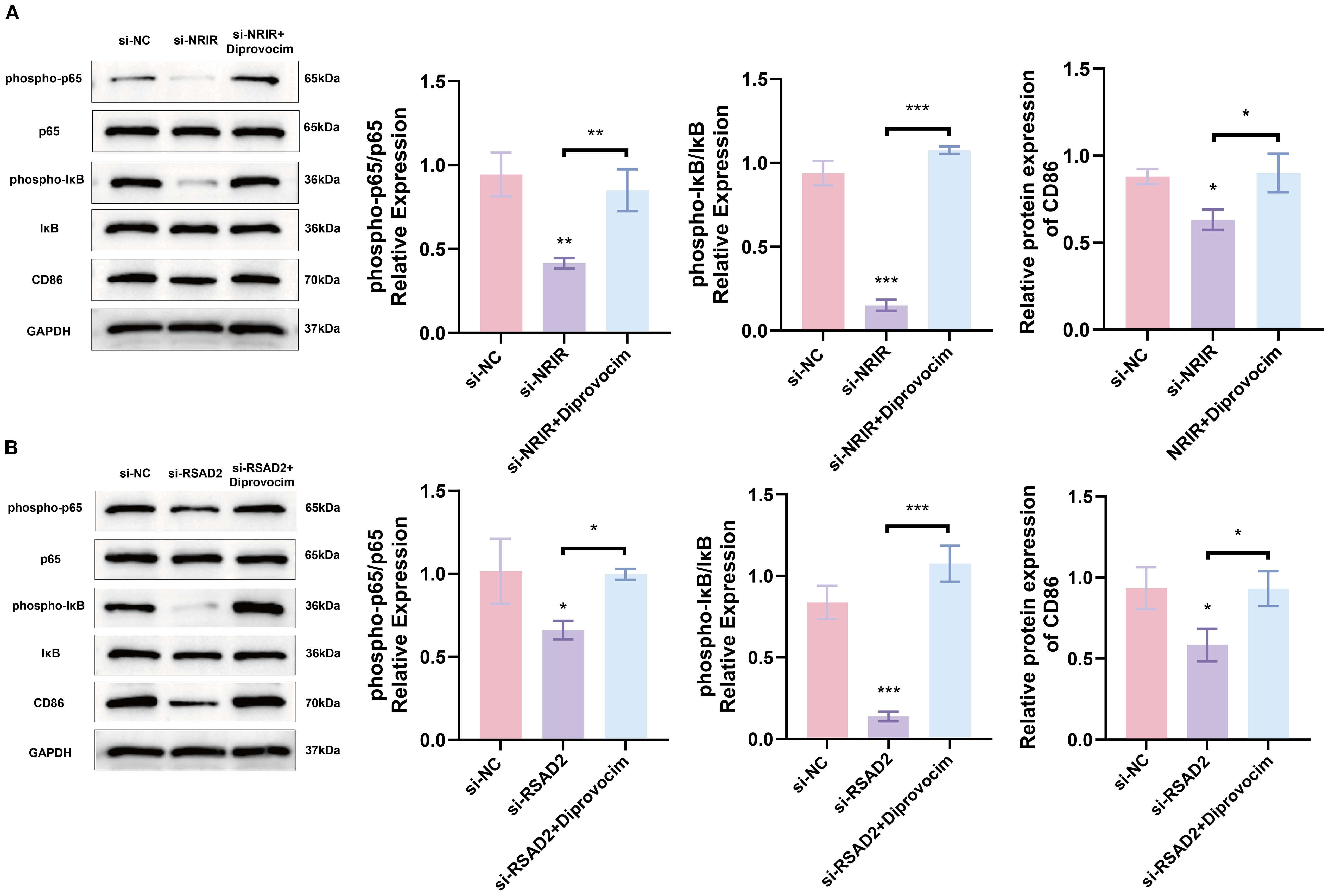 Western blot analysis and bar graphs show the expression of proteins phospho-p65, p65, phospho-IκB, IκB, and CD86, with GAPDH as the loading control. Panel A compares si-NC, si-NRIR, and si-NRIR with Diprovocim groups, while Panel B compares si-NC, si-RSAD2, and si-RSAD2 with Diprovocim groups. Relative expression levels are quantified in the bar graphs, indicating significant changes marked by asterisks representing statistical significance.