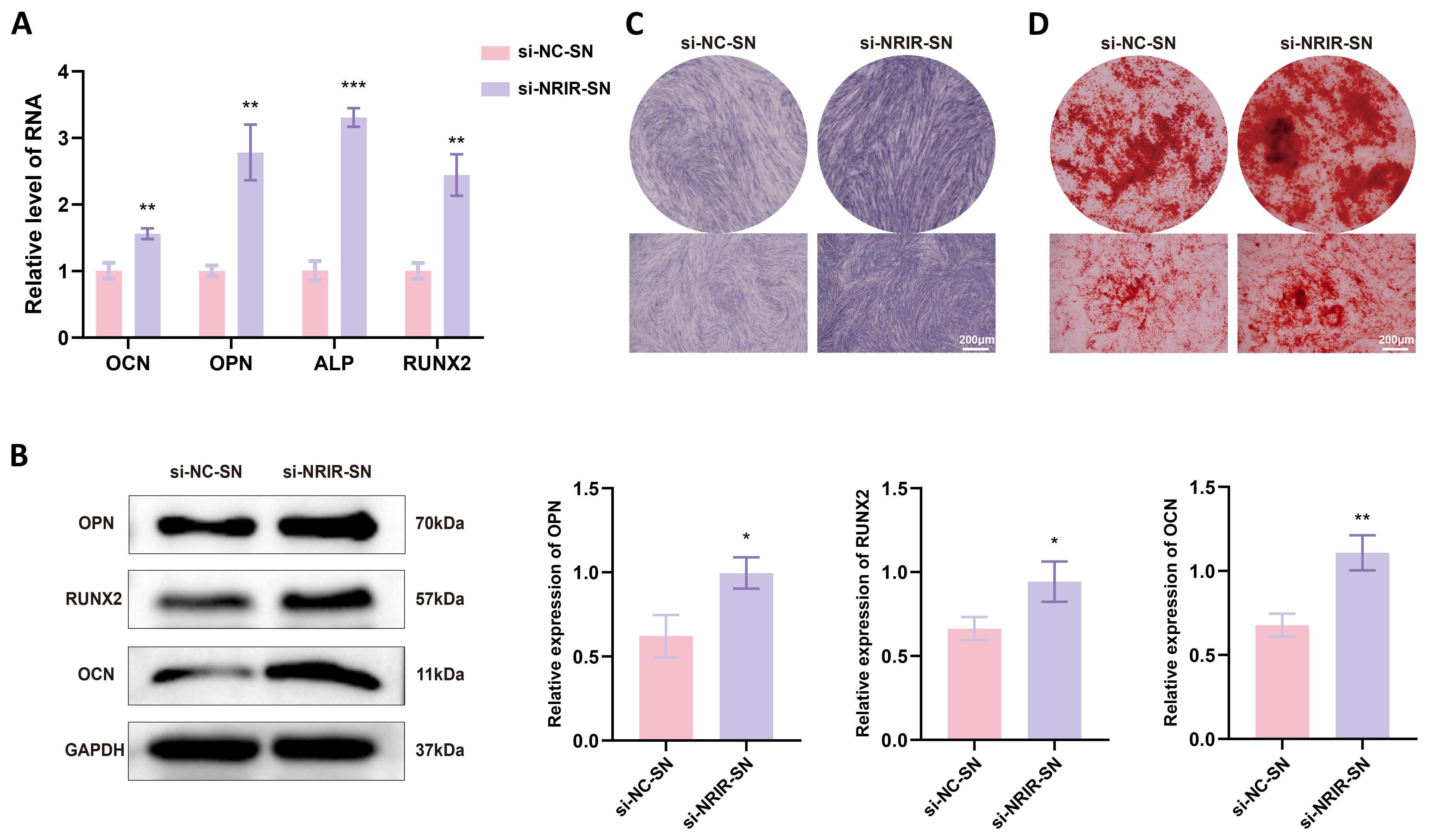Panel A shows a bar graph comparing the relative RNA levels of OCN, OPN, ALP, and RUNX2 between si-NC and si-NRIR, with higher levels in si-NRIR. Panel B displays Western blot images for OPN, RUNX2, OCN, and GAPDH with corresponding bar graphs, indicating increased protein expression in si-NRIR. Panels C and D present microscopic images comparing cellular morphology and staining between si-NC-SN and si-NRIR-SN, showing denser staining in si-NRIR-SN with a scale bar of two hundred micrometers.