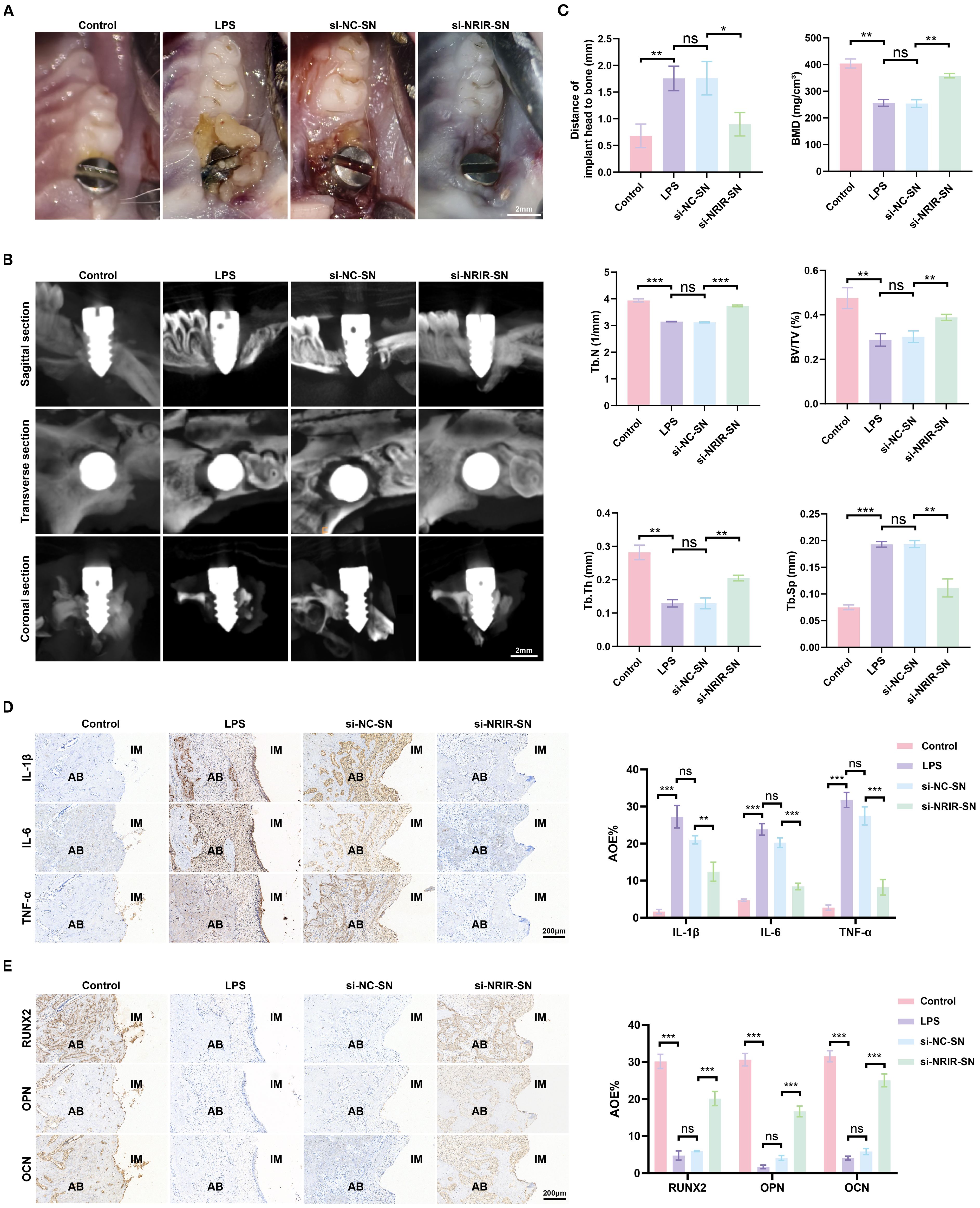 Figure composed of four panels showing experimental results. Panel A displays images of dental implants in four conditions: Control, LPS, si-NC-SN, and si-NRIR-SN. Panel B features radiographic sections—sagittal, transverse, and coronal—of implants under the same conditions. Panel C presents bar graphs comparing various metrics like the distance of implant-bone edge, BMD, Tb.N, BV/TV, Tb.Th, Tb.Sp across conditions, with statistical significance indicated. Panel D includes immunohistochemical staining for IL-1β, IL-6, and TNF-α, with corresponding graph. Panel E shows staining for RUNX2, OPN, and OCN, with respective bar graph.