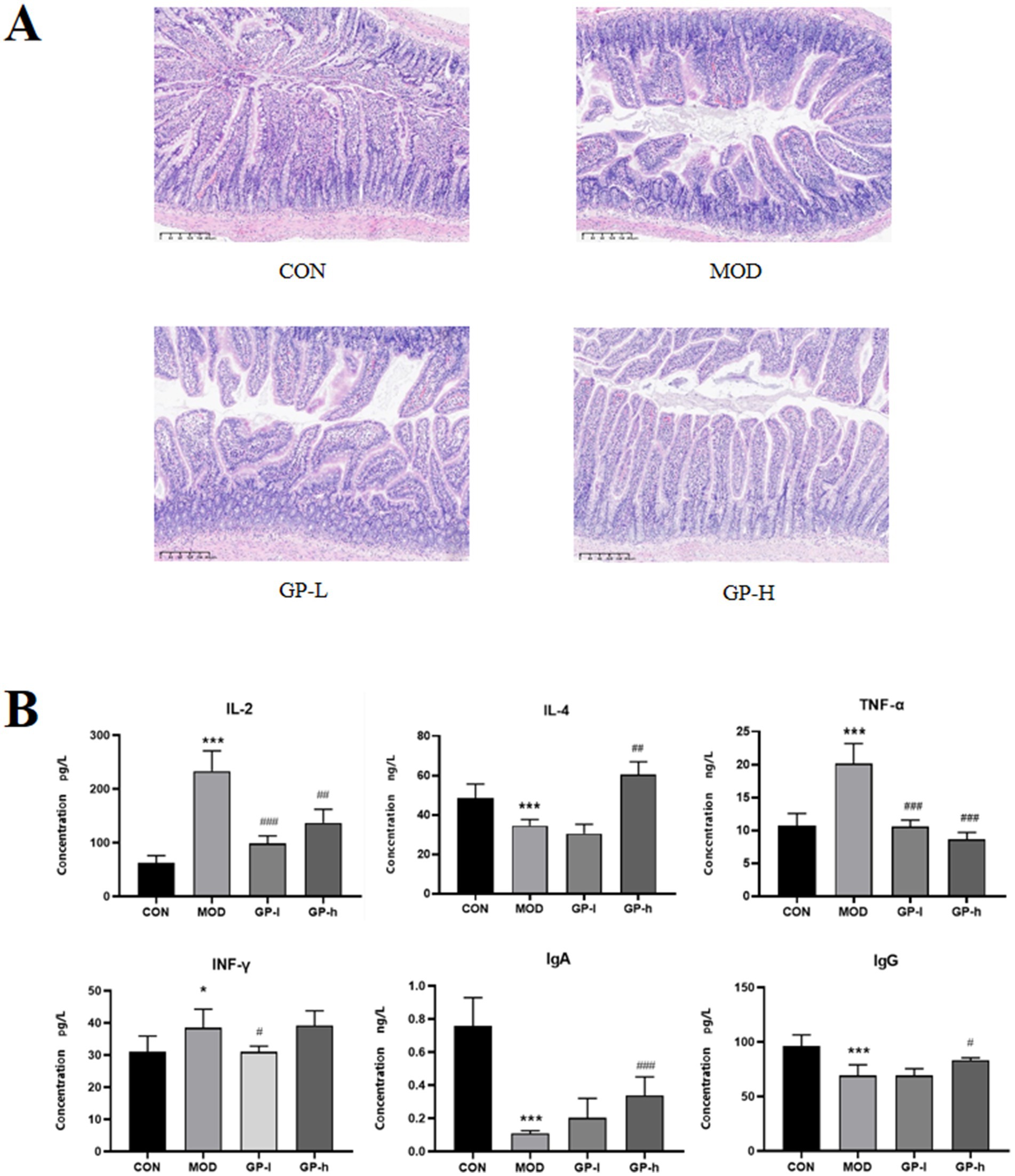 Panel A shows histological images comparing four groups: CON, MOD, GP-L, and GP-H, with varying tissue structures. Panel B presents bar graphs displaying the concentrations of IL-2, IL-4, TNF-α, INF-γ, IgA, and IgG across the same groups, highlighting significant differences in immune marker levels indicated by asterisks and hashes.