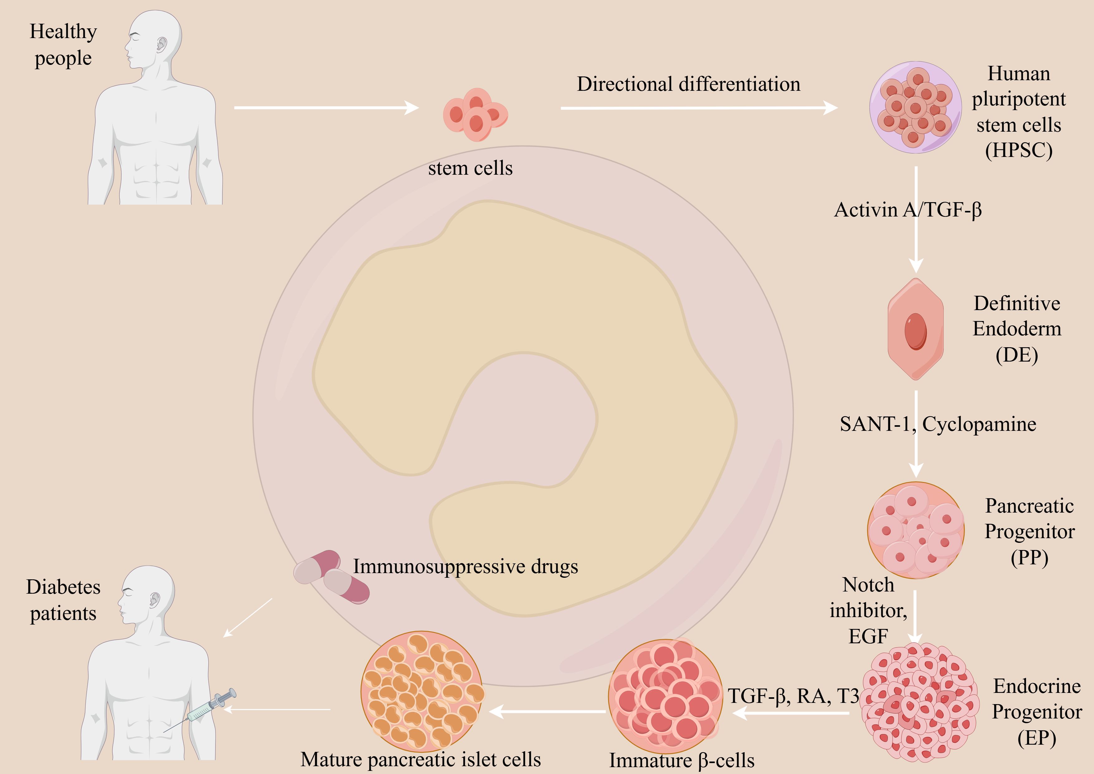 Diagram illustrating the differentiation of human pluripotent stem cells into mature pancreatic islet cells for diabetes treatment. It starts with stem cells from healthy individuals, undergoing directional differentiation into definitive endoderm, pancreatic progenitors, and immature beta-cells through various signaling molecules. The final mature pancreatic islet cells are then used for diabetes patients with the aid of immunosuppressive drugs.