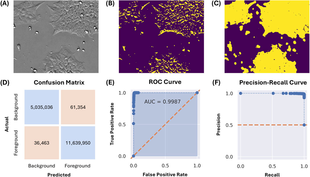 (A) Grayscale microscopy image of cells. (B) Corresponding segmentation mask highlighting cell boundaries in yellow against a purple background. (C) Another segmentation mask with more extensive yellow regions indicating cell areas. (D) Confusion matrix with values showing true positives, false positives, true negatives, and false negatives. (E) ROC curve displaying a high area under the curve (AUC) of 0.9987, indicating strong model performance. (F) Precision-recall curve illustrating high precision and recall values, signifying model accuracy in distinguishing between foreground and background.