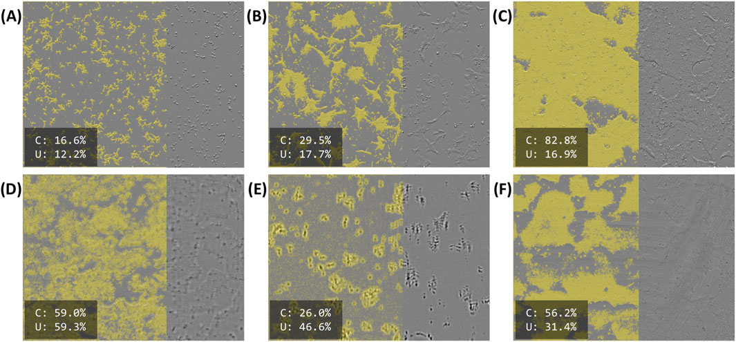 Images A to F depict grayscale microscopic views of cellular structures with areas highlighted in yellow. Each image includes labeled sections with confluency marked as C (concentration) and U (uncertainty). Values vary across images, with concentrations ranging from 16.6% to 82.8% and unknown values from 12.2% to 59.3%.