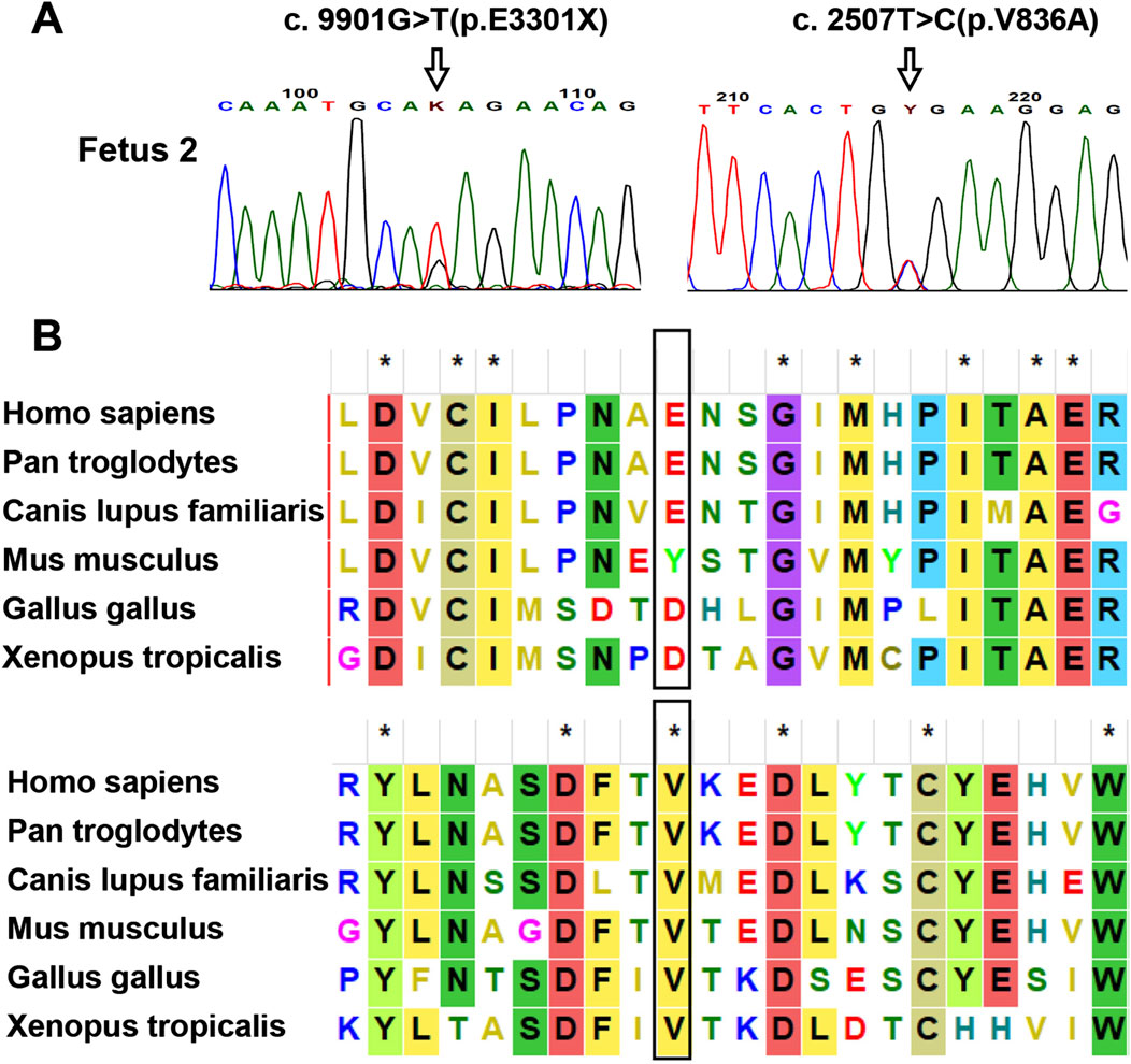 Genetic analysis of Fetus 2. Panel A shows Sanger sequencing chromatograms verifying two heterozygous PKHD1 variants: c.9901G>T (p.Glu3301Ter) and c.2507T>C (p.Val836Ala), with mutated sites marked by arrows. Panel B displays a multiple sequence alignment showing the Val836 residue is highly conserved across species, while the Glu3301 residue is not.
