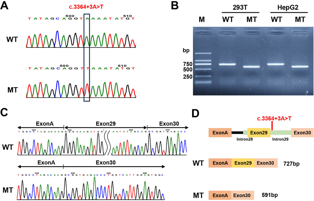 Minigene assay analyzing the PKHD1 c.3364+3A>T splice site variant. Panel A shows Sanger sequencing verifying the wild-type (WT) and mutant (MT) minigene constructs. Panel B displays agarose gel electrophoresis of RT-PCR products from transfected cells showing a smaller band for MT than WT. Panel C shows sequencing of the PCR products confirming exon 29 skipping in the MT sample. Panel D is a schematic diagram illustrating how the c.3364+3A>T mutation causes exon 29 skipping.