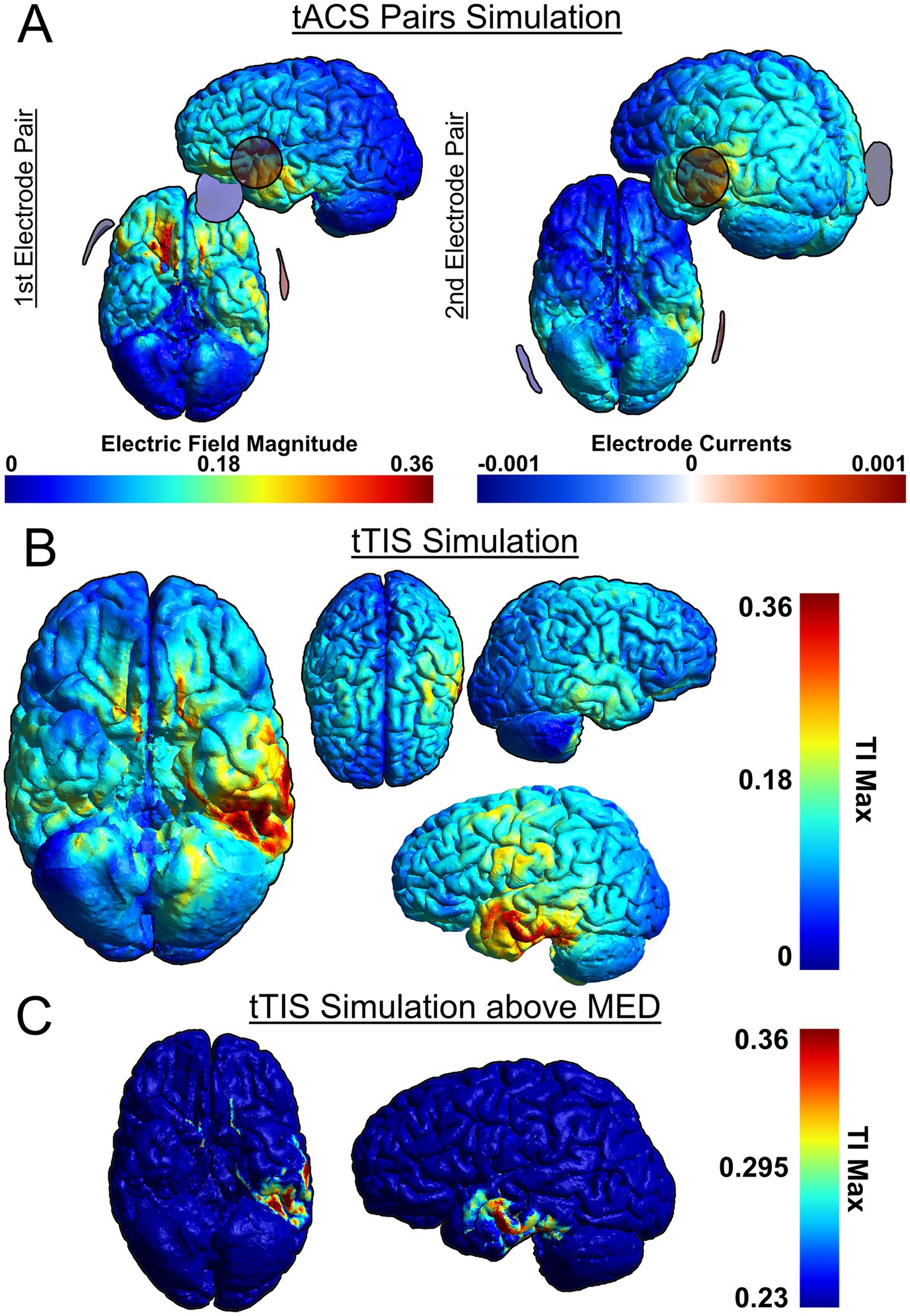 Simulation images show the distribution of electrical fields on brain models. Panel A illustrates two tACS pairs with color scales for electric field magnitude and electrode currents. Panel B shows a tTIS simulation based on the two electrode pairs shown in Panel A with intensity distribution on different brain views. Panel C depicts a tTIS simulation above MED with similar distributions, focused on maximum TI values.