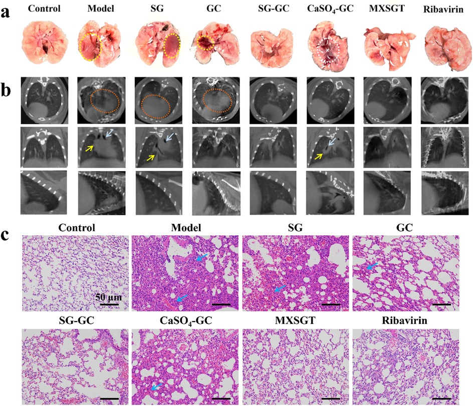 Comparison of lung conditions under different treatments. Panel (a) shows physical lung appearance across treatments such as Control, Model, and various compounds, indicating differing damage levels. Panel (b) presents CT scans with highlighted areas signifying affected regions. Panel (c) illustrates microscopic histopathology images of lung tissue with staining, comparing alveolar structure and inflammation, annotated with color-coded markers. The diversity in condition response is visually evident.