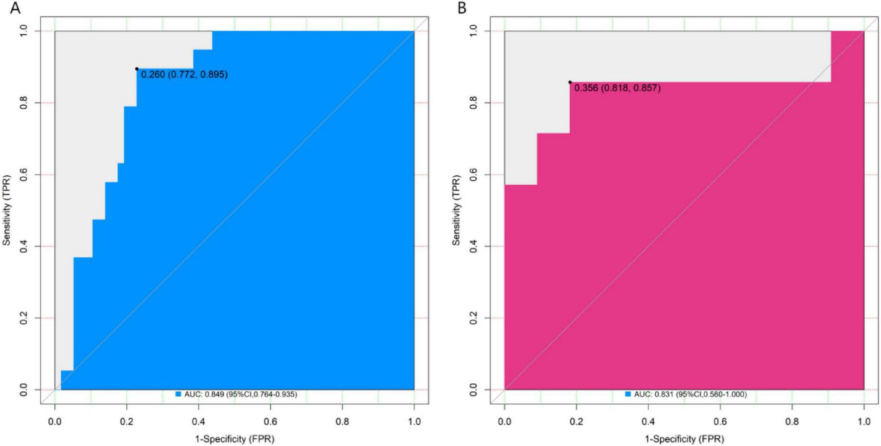 Two ROC curve charts labeled A and B compare sensitivity versus 1-specificity. Chart A is blue with an AUC of 0.849 and confidence interval of 0.764 to 0.935. Chart B is pink with an AUC of 0.831 and confidence interval of 0.560 to 1.000. Both charts feature shaded areas under the curves and a diagonal reference line.