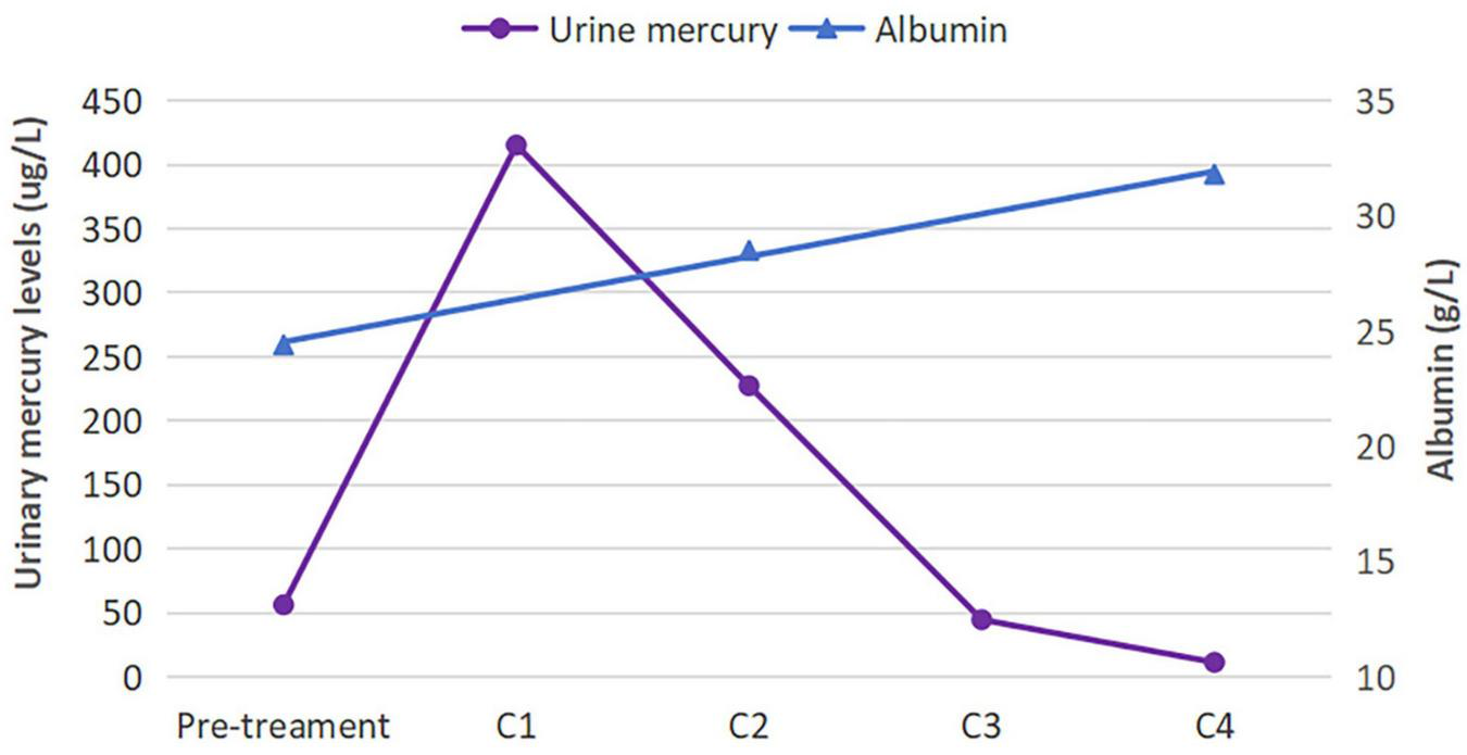Line graph showing urinary mercury levels (purple line) and albumin levels (blue line) over time from pre-treatment to C4. Urinary mercury peaks at C1 then declines sharply by C4. Albumin levels steadily increase from 25 g/L pre-treatment to about 32 g/L at C4.