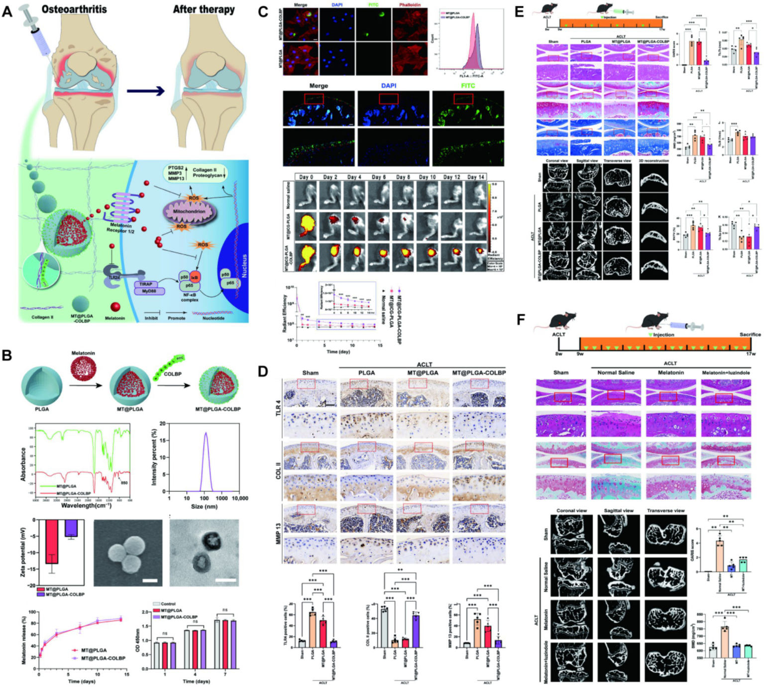 Research infographic illustrating various panels related to osteoarthritis therapy. Panel A shows a schematic of osteoarthritis before and after treatment, highlighting drug delivery mechanisms. Panel B depicts the preparation of nanoparticles and their characterization, including graphs on absorbance and size distribution. Panel C includes microscopy images and a graph of treatment monitoring over time. Panel D presents staining images showing protein expression levels with bar graphs for quantification. Panel E shows animal models and histological images, accompanied by statistical analyses. Panel F illustrates experimental timelines for animal studies and associated histological and imaging results with comparative bar graphs.