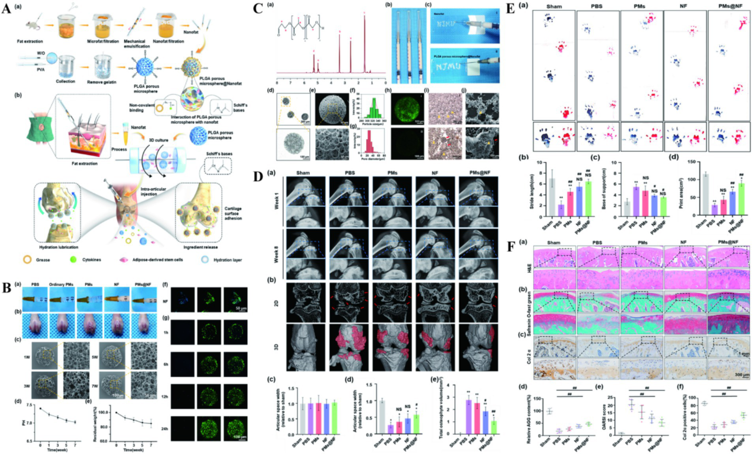 Scientific infographic illustrating a multi-panel experimental study. Panel A shows a flowchart of the process for creating PLGA porous microspheres and their application in cartilage treatment. Panel B displays experimental results and observations including images of samples and graphs of data over time. Panel C features various sample analyses, including chemical structures, images of materials, and histograms. Panel D presents MRI scans at different weeks comparing various treatments. Panel E shows histological staining with corresponding graphs of cytokine levels. Panel F illustrates tissue sections stained for analysis along with related data plots. Each panel contains labeled subfigures detailing specific aspects of the study.
