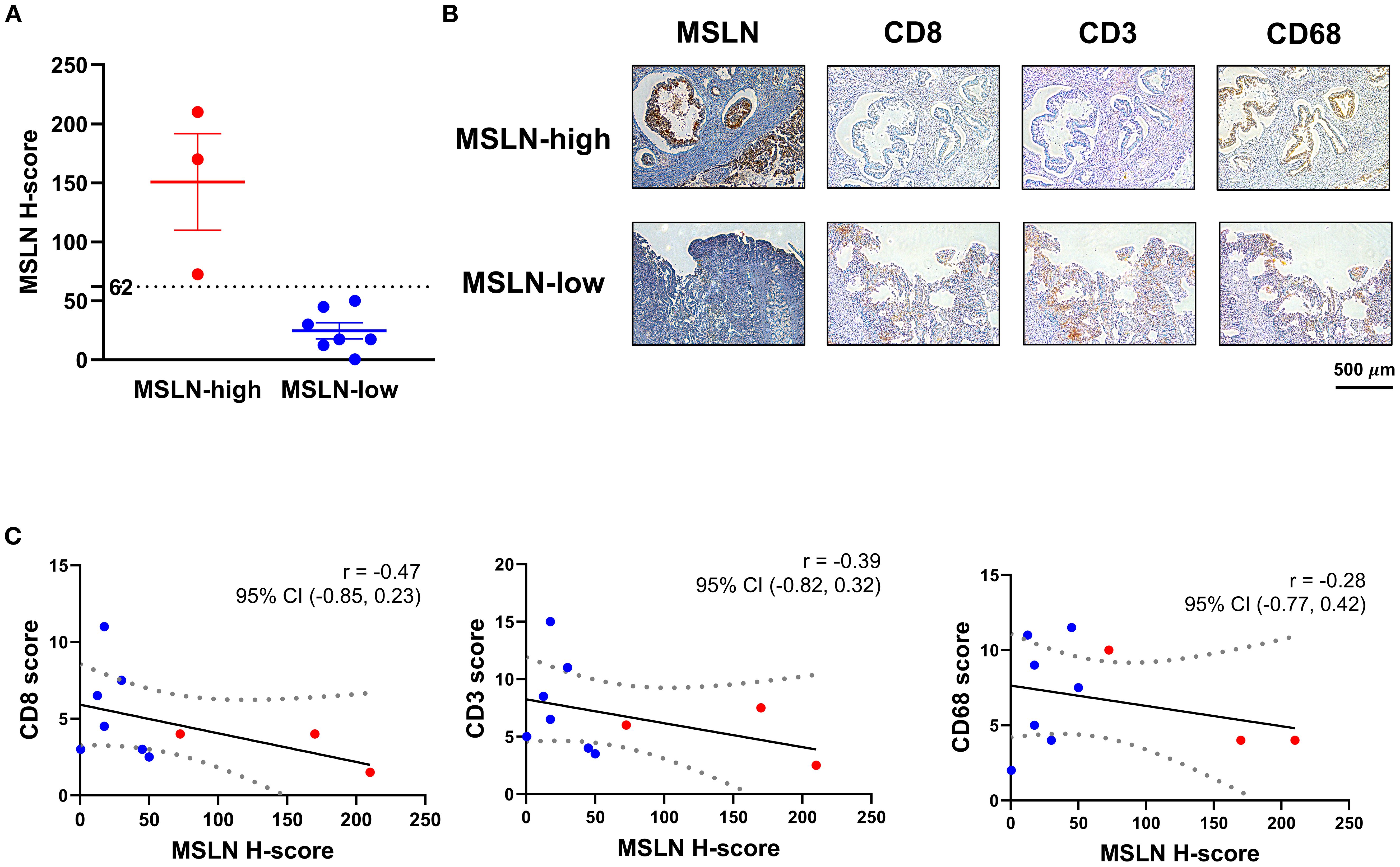 Pancreatic cancer sections stained with MSLN, CD8, CD3, and CD68. Panel A shows distribution of MSLN H-score from the MSLN-high and MSLN-low groups. Panel B shows representative immunohistochemistry staining images of samples from MSLN-high and MSLN-low groups. Panel C shows the correlation of MSLN with CD8, CD3, and CD68 scores across all 10 samples, with negative correlation efficients of -0.47, -0.39, and -0.28, respectively.