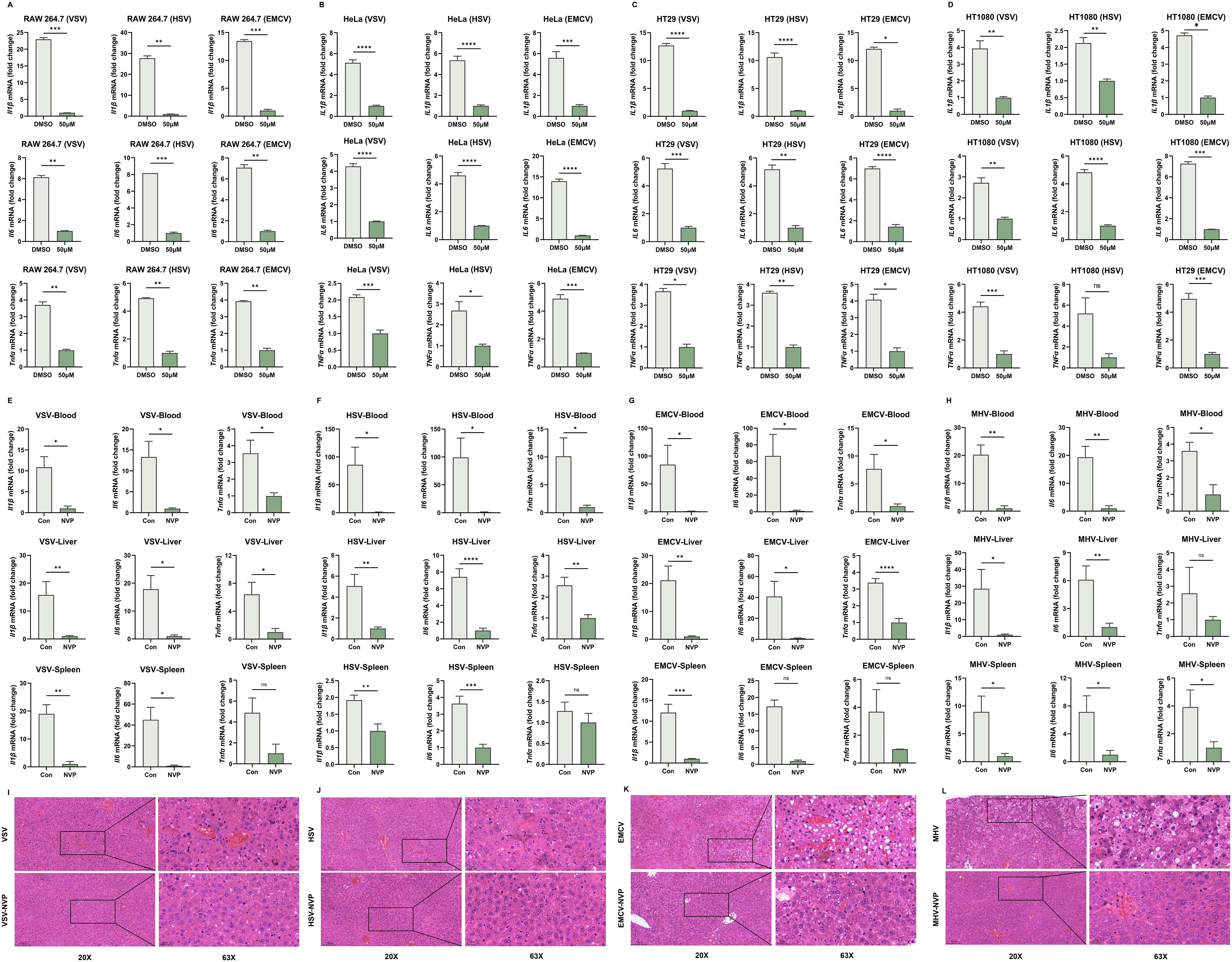 The bar graphs show the effects on viral infectivity in various cell lines, including RAW264.7, HeLa, HT29 and HT1080 indicated by significant differences between DMSO and 50μM NVP in vitro; Control and NVP treatments in vivo.