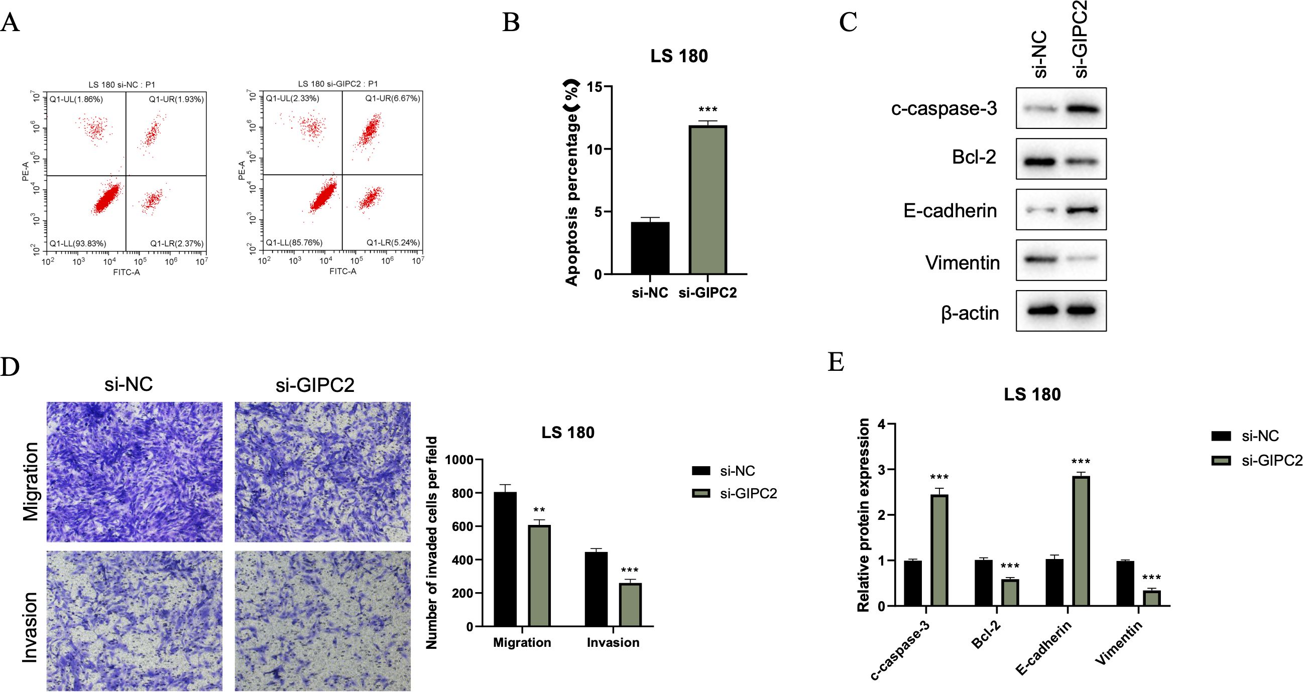 Flow cytometry and analysis of LS 180 cells show increased apoptosis in si-GIPC2 compared to si-NC. Western blotting results show changes in protein expression for c-caspase-3, Bcl-2, E-cadherin, Vimentin, and β-actin. Microscopic images depict cell migration and invasion differences between conditions. Bar graphs quantify apoptotic percentage and protein expression, with significant differences marked.