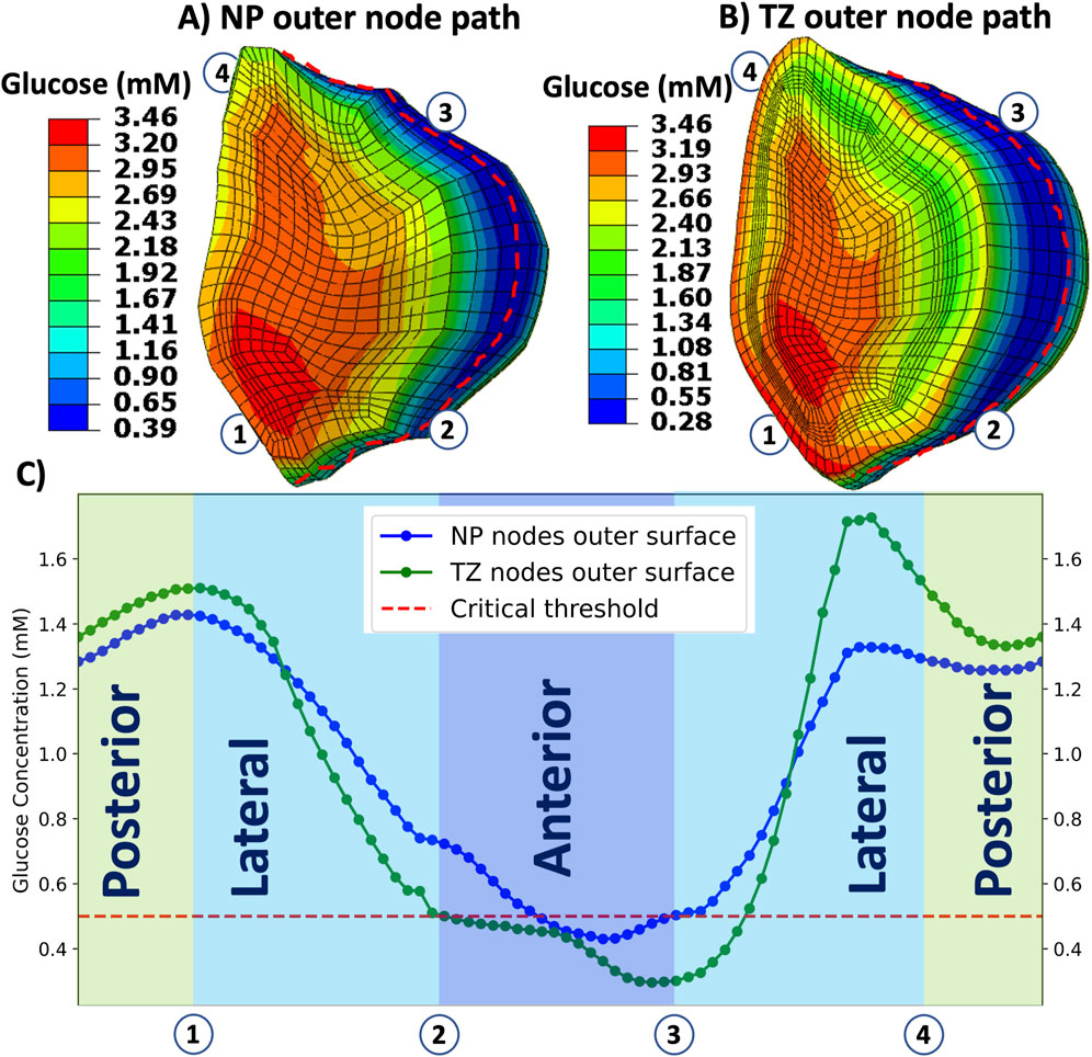 Three graphics visualize glucose concentration variations. A) NP outer node path with a color gradient from red (high) to blue (low) glucose levels. B) TZ outer node path displays similar patterns. C) A graph shows glucose concentration along different sections (posterior, lateral, anterior) with blue and green lines representing NP and TZ nodes, respectively, against a red-dashed critical threshold.