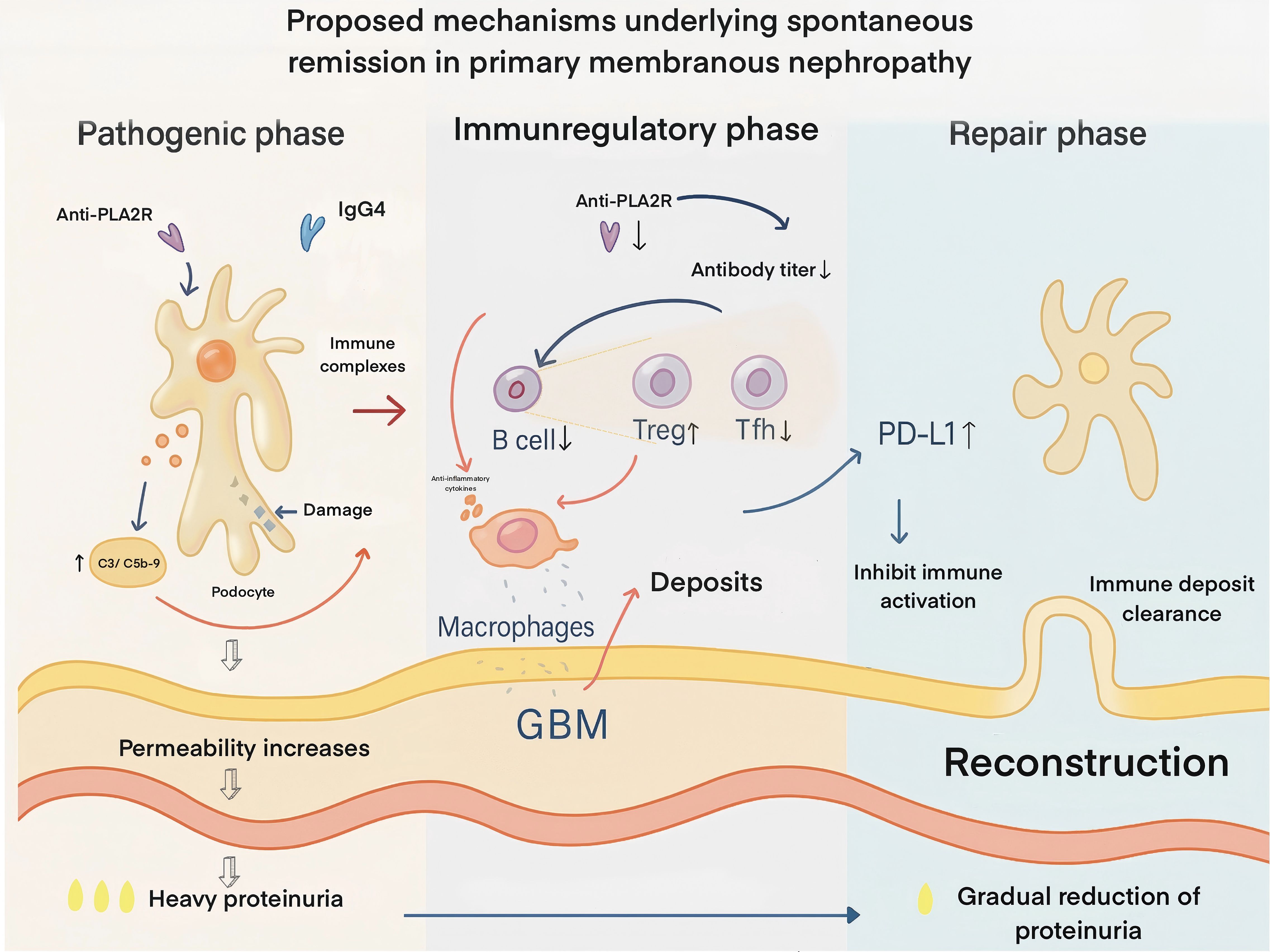 Diagram illustrating proposed mechanisms of spontaneous remission in primary membranous nephropathy across three phases: pathogenic, immunoregulatory, and repair. The pathogenic phase shows damage and increased proteinuria due to immune complexes. The immunoregulatory phase involves decreased antibody titers and increased anti-inflammatory cytokines. The repair phase highlights immune activation inhibition and deposit clearance, leading to proteinuria reduction.