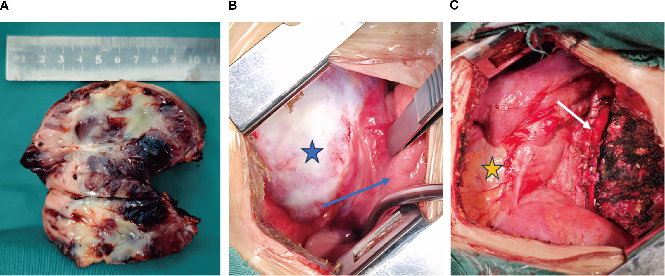 Panel A shows a cut section of a lung with necrotic tissue marked by dark areas and mucus. Panel B displays an opened chest cavity with a clear plastic covering and exposed red tissue. A blue star and arrow highlight a specific area. Panel C reveals another view of the chest cavity with an exposed organ. A white arrow and yellow star indicate particular locations, with visible tissue damage nearby.