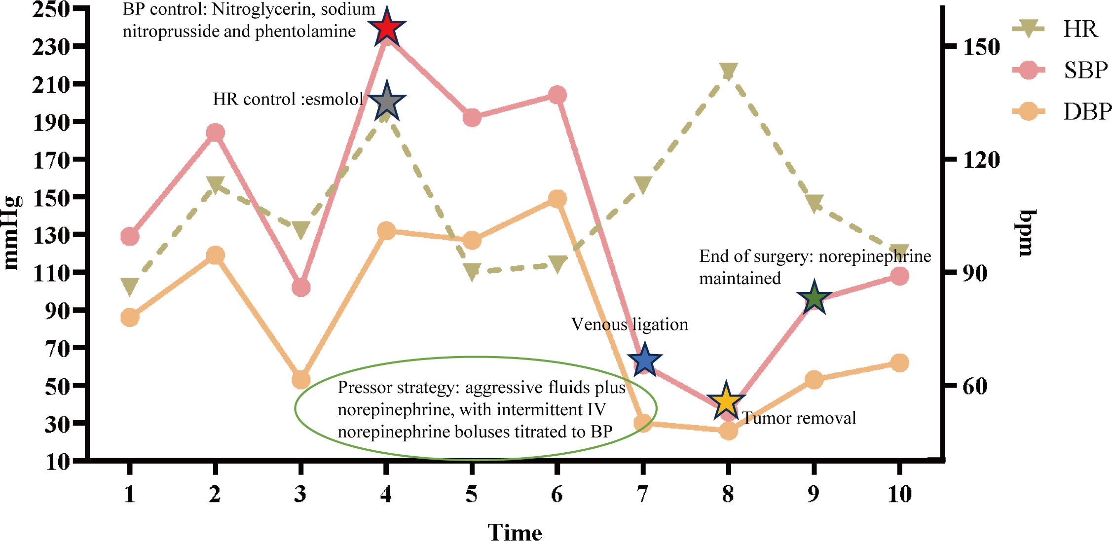 Graph depicting blood pressure and heart rate changes over time during a surgical procedure. The y-axes represent blood pressure in millimeters of mercury and heart rate in beats per minute. Colored lines indicate systolic blood pressure (pink), diastolic blood pressure (orange), and heart rate (green). Key milestones include “BP control,” “HR control,” “Venous ligation,” “Tumor removal,” and “End of surgery” with norepinephrine management. Text notes the pressor strategy used during the operation.