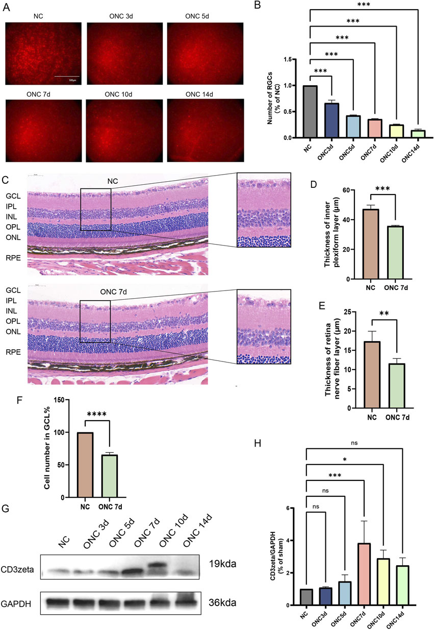 Panel A displays retinal images over time (NC, ONC 3d, 5d, 7d, 10d, 14d) showing changes in appearance. Panel B is a bar graph comparing the number of RGCs across different time points, indicating significant reductions. Panel C shows histological sections of the retina for NC and ONC 7d, highlighting differences in retinal layers. Panel D and E are bar graphs indicating changes in the thickness of the inner plexiform and retina nerve fiber layers respectively. Panel F shows a significant decrease in cell number in GCL for ONC 7d compared to NC. Panel G displays protein expression results for CD3zeta and GAPDH over time. Panel H is a bar graph showing relative protein expression levels, with some significant differences noted.