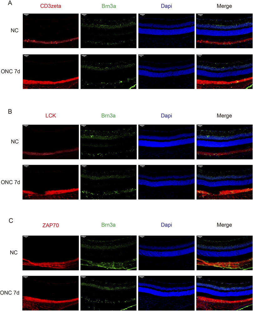 Fluorescent images display retinal sections showing expression of CD3zeta, LCK, and ZAP70 in red, Brn3a in green, and nuclei in blue, with merged views on the right. Each row compares normal (NC) and 7 days post-optic nerve crush (ONC 7d) conditions, highlighting differences in protein expression patterns. Panel A shows CD3zeta, panel B shows LCK, and panel C shows ZAP70 expression.