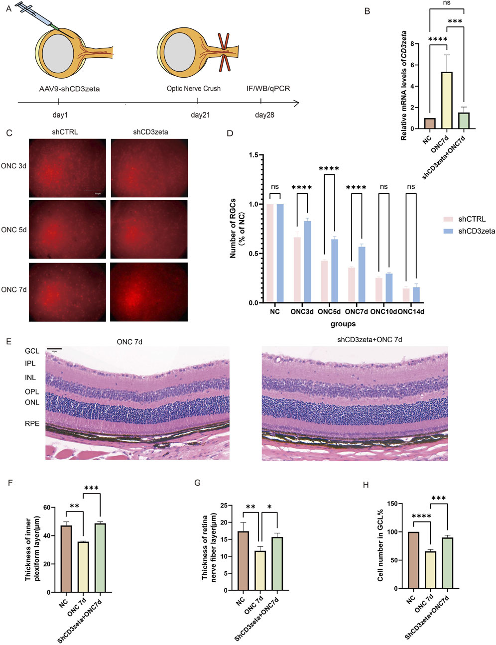 The figure consists of several panels related to a scientific study on optic nerve crush (ONC). Panel A shows a timeline of an experimental procedure involving AAV9-shCD3zeta injection and subsequent optic nerve crush with analysis by IF/WB/qPCR. Panel B presents a bar graph showing relative mRNA levels of CD3zeta in various conditions with significant differences marked. Panel C displays images of retinal ganglion cells (RGCs) stained in red at different days post-optic nerve crush in shCTRL and shCD3zeta groups. Panel D is a bar graph showing the number of RGCs as a percentage of NC across different days, indicating statistical significance. Panel E shows the cross-sectional image of the retina on the 7th day after optic nerve compression with or without virus injection. Panels F, G, and H are bar graphs showing the thickness of the inner plexiform layer, retina nerve fiber layer, and the cell number in the ganglion cell layer, respectively, with statistical significance indicated.