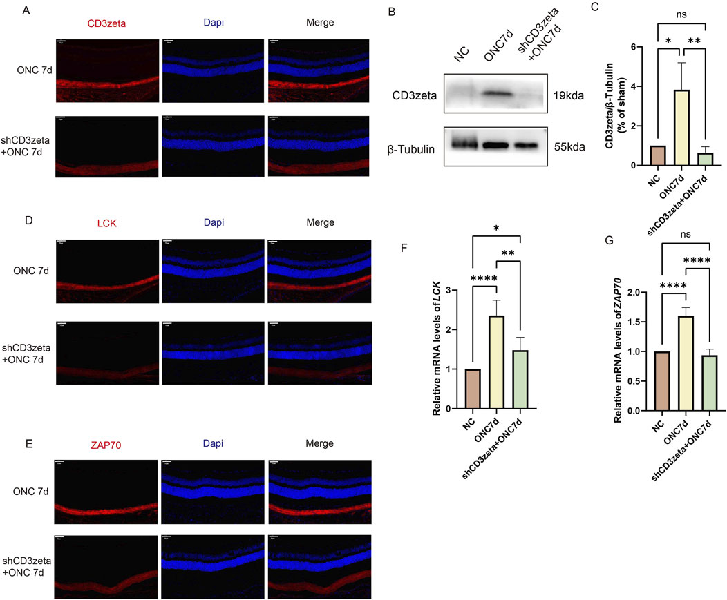 Immunofluorescence images and bar graphs depict the expression levels of CD3zeta, LCK, and ZAP70. Panels A, D, and E show ONC-treated and shCD3zeta+ONC-treated retinal sections stained with antibodies for CD3zeta, LCK, and ZAP70, respectively, along with DAPI for nuclei. Panel B displays a Western blot for CD3zeta and β-Tubulin. Bar graphs C, F, and G present quantitative analyses of the protein and mRNA expression levels, showing significant differences as indicated by asterisks.