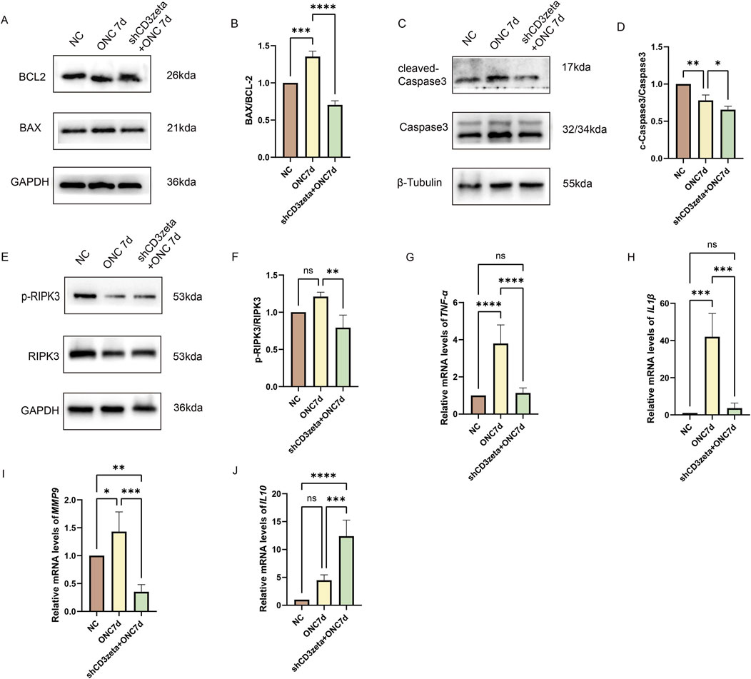 Western blot and bar graph panels illustrate protein and mRNA expression in various experimental conditions. Panel A shows BCL2, BAX, and GAPDH expression. Panel B quantifies BAX/BCL2 ratios. Panel C shows cleaved-Caspase3, Caspase3, and β-Tubulin expression. Panel D quantifies cleaved-Caspase3/Caspase3 ratios. Panel E shows p-RIPK3, RIPK3, and GAPDH expression. Panel F quantifies p-RIPK3/RIPK3 ratios. Panels G-J display relative mRNA levels of TNF-α, IL1β, MMP9, and IL10. Statistical significance is indicated by asterisks, with comparisons across NC, ONC 7d, and shCD3zeta+ONC7d conditions.