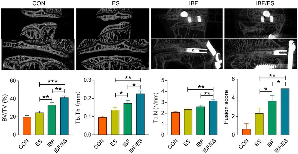 Figure showing comparative micro-CT images and quantitative analyses of vertebral bone in four groups: control (CON), oral Eupolyphaga sinensis extract (ES), interbody fusion (IBF), and combined IBF with ES (IBF/ES). Three-dimensional reconstructions show intact laminae and reduced intervertebral height in CON and ES groups; heterogeneous signals and visible endplate boundaries in IBF group; and clear trabecular connections with loss of bone gap and endplate boundary in IBF/ES group. Bar graphs display statistically significant increases in bone volume fraction (BV/TV), trabecular thickness (Tb.Th), trabecular number (Tb.N), and fusion score in the IBF/ES group compared to other groups.