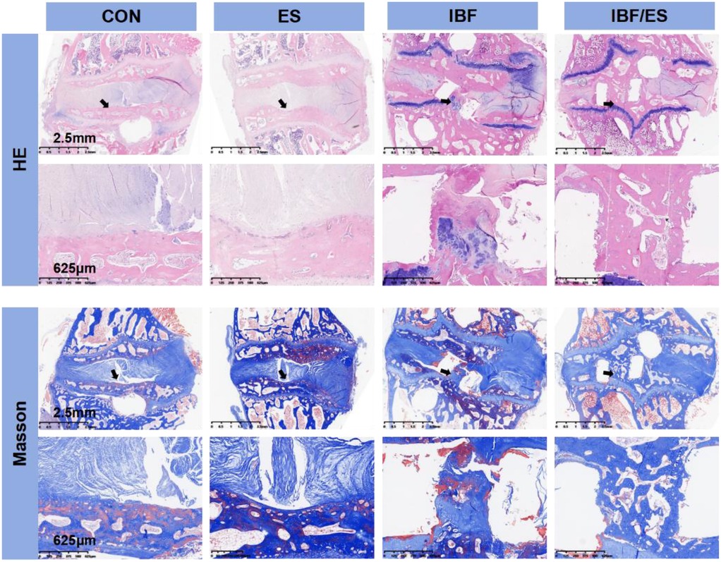 Histological images comparing vertebral bone healing and endplate vascularization across four groups–CON, oral Eupolyphaga sinensis extract (ES), interbody fusion (IBF), and combined IBF with ES (IBF/ES)–using H&E and Masson's trichrome staining at low and high magnifications. Black arrows indicate bone fusion areas. CON and IBF groups show fewer blood vessels and incomplete bone connections. The ES group displays increased blood vessels in the cartilage endplate region and some bone extending into the intervertebral space. The IBF/ES group exhibits a complete bony bridge between endplates, dense and organized trabecular bone formation, and rich vascularization.