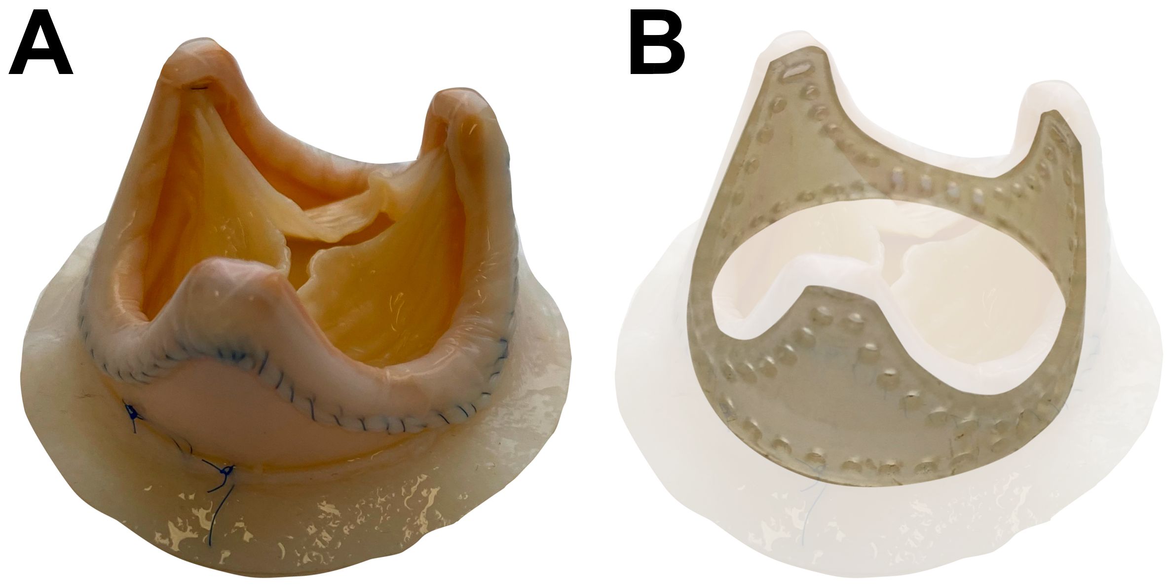 The PeriCor bioprosthetic heart valve: general view and the visual representation is provided to illustrate the configuration of the supporting polypropylene frame.