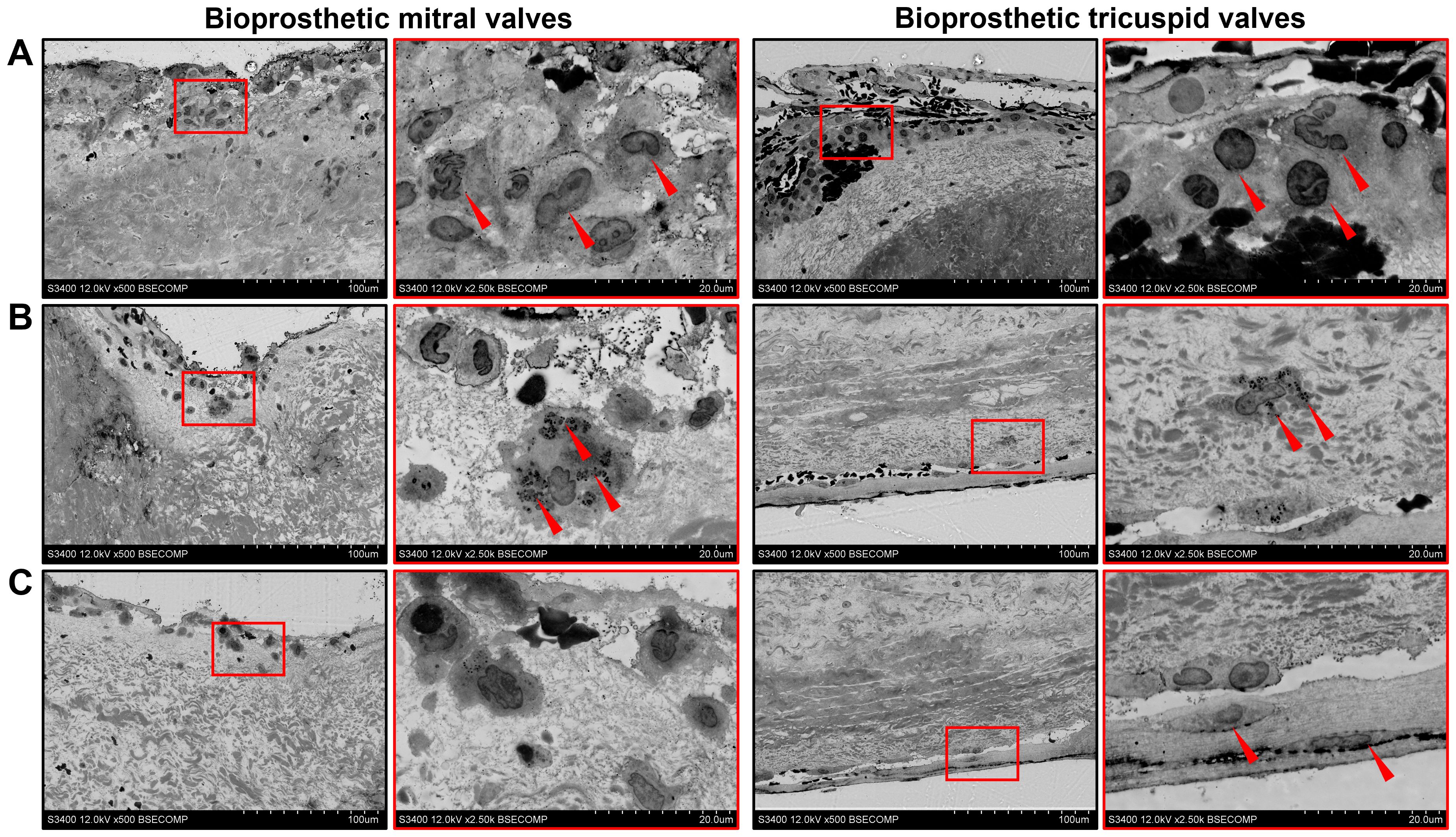 Images of scanning electron microscopy after epoxy resin embedding comparing bioprosthetic mitral and tricuspid valves. The left column shows sections of mitral valves, while the right column shows tricuspid valves. Red arrows indicate specific features within magnified sections, highlighting cellular and structural details. Three panels labeled A, B, and C depict different sample observations. Red boxes identify areas of interest within the larger context.