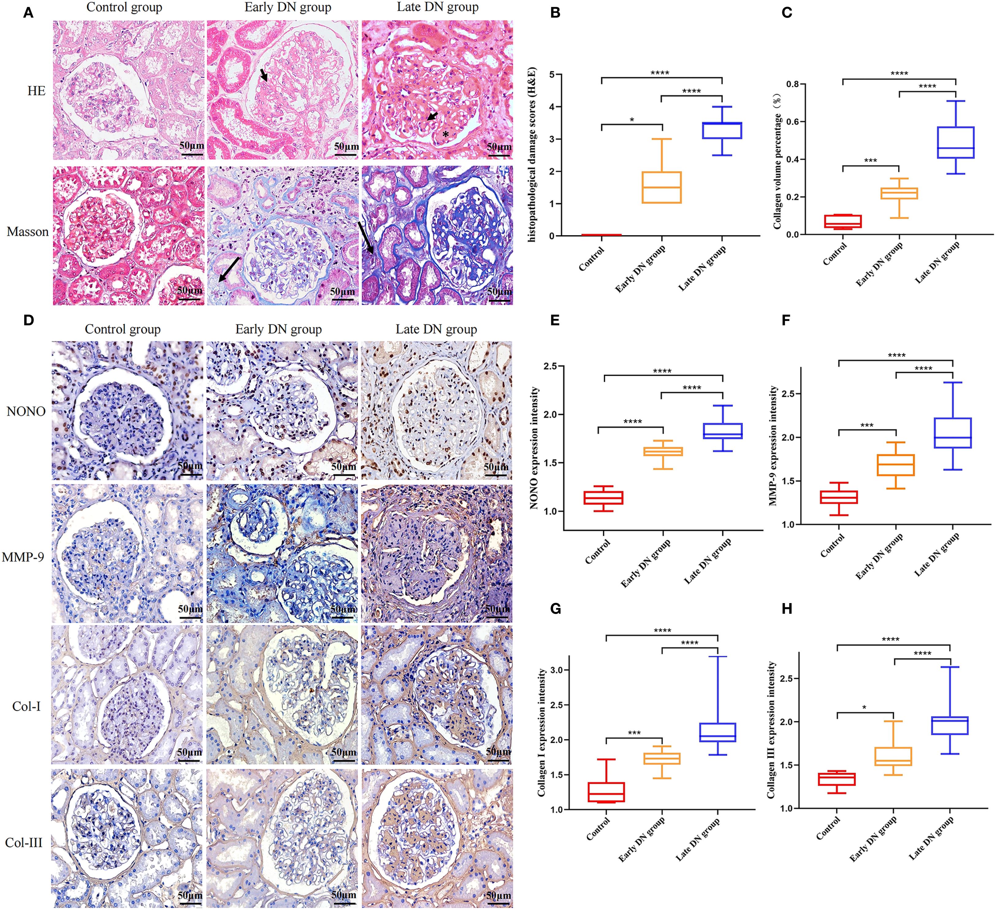 Histological and statistical data compare control, early diabetic nephropathy (DN), and late DN groups. Panels A and D show stained kidney tissue sections with varying expressions of histological markers: HE, Masson, NONO, MMP-9, Col-I, and Col-III. Graphs B, C, E, F, G, and H present box plots with significant differences among the groups in terms of histopathological scores, collagen content percentage, and expression intensities of markers, marked by asterisks indicating levels of significance. Scale bars indicate 50 micrometers.