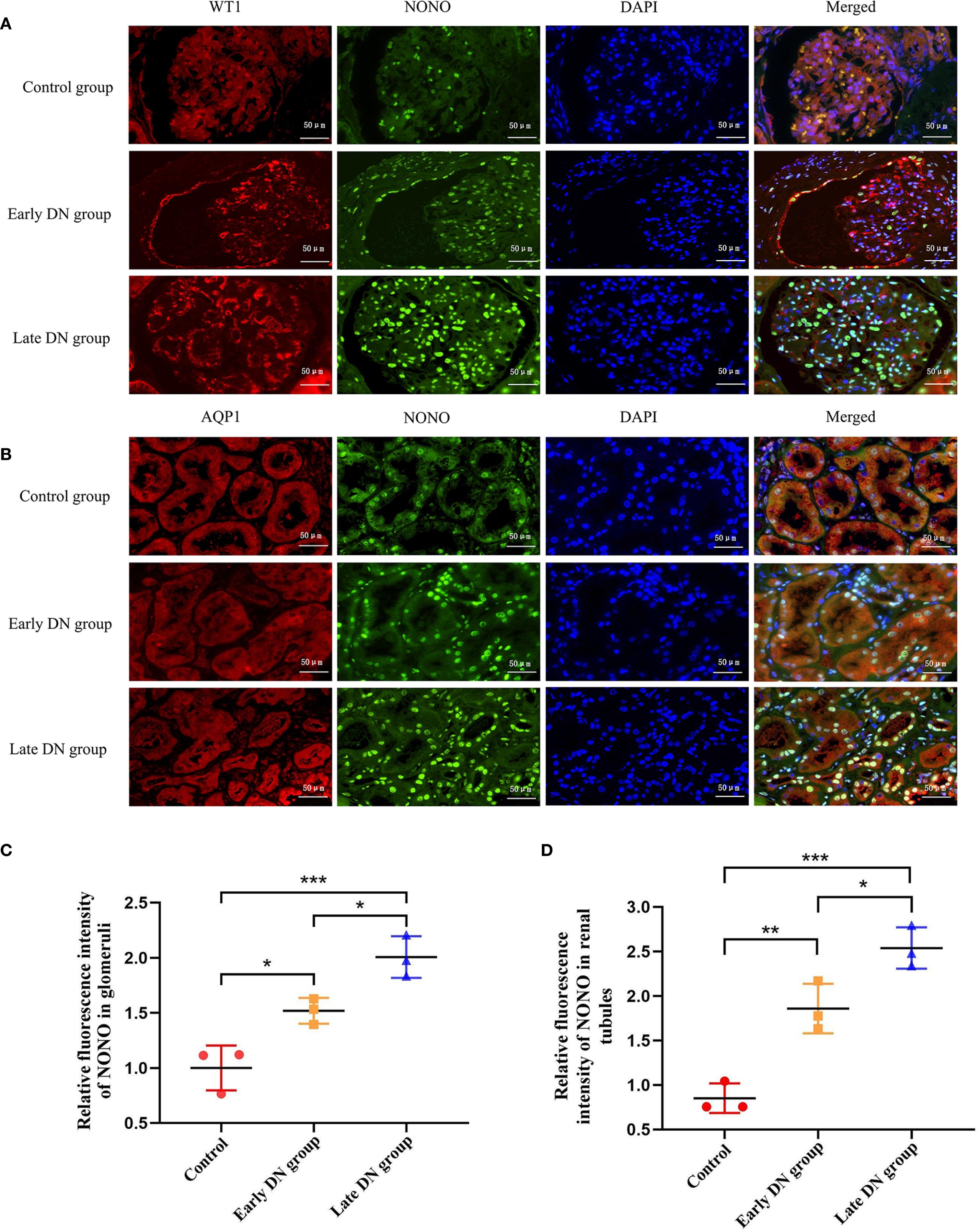 Panel A shows immunofluorescence images comparing WT1, NONO, and DAPI in glomeruli of control, early DN, and late DN groups. Panel B displays similar images for AQP1, NONO, and DAPI in renal tubules. Panels C and D are bar graphs showing the relative fluorescence intensity of NONO in glomeruli and renal tubules across the groups, with significant differences indicated. Scale bars represent fifty micrometers.