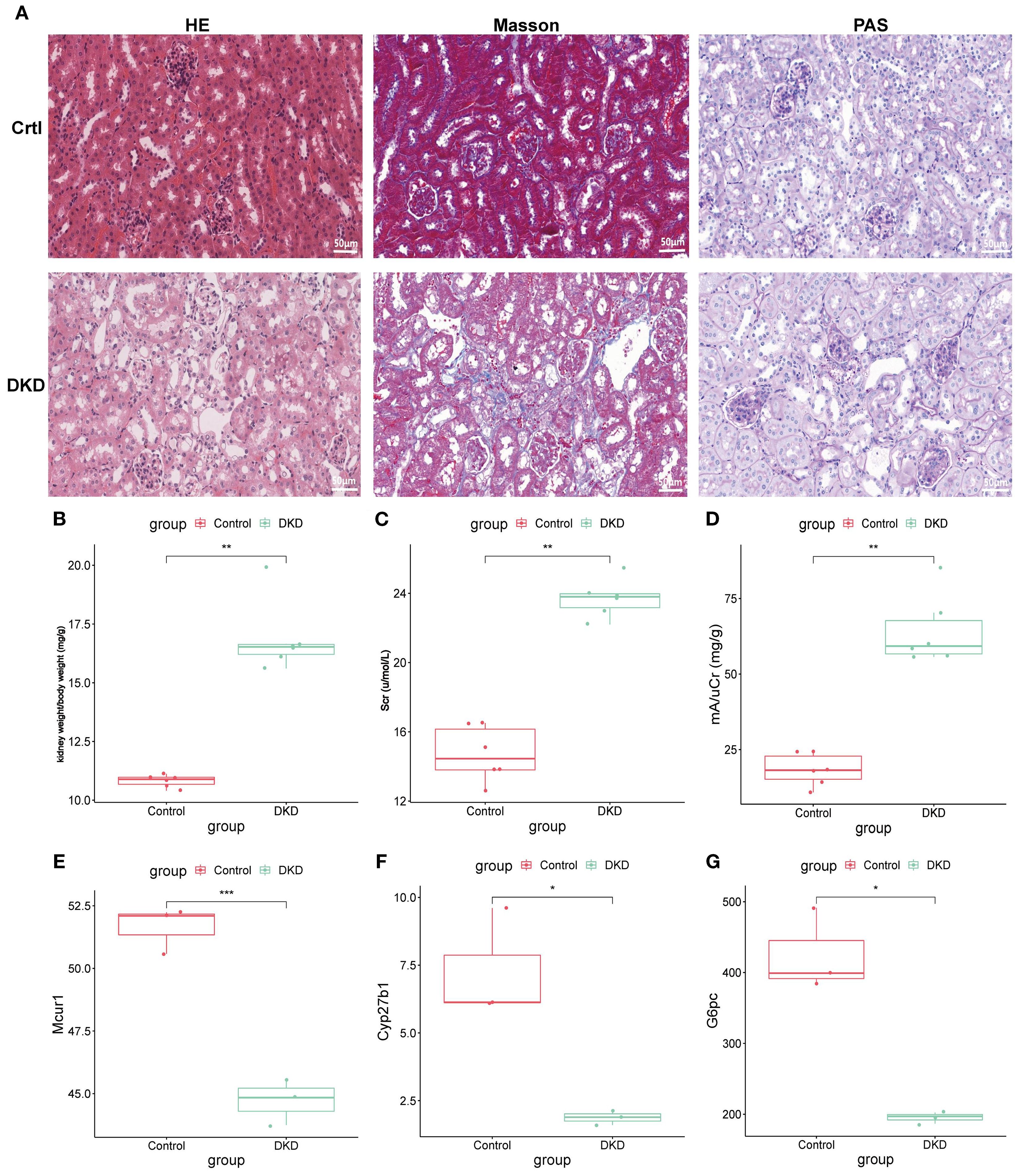 Microscopic images and box plots comparing control and DKD groups. Panel A shows kidney tissue stained with HE, Masson's trichrome, and PAS. The control group exhibits less alteration, while DKD samples show increased pathological changes. Panels B to G present box plots of kidney function indicators and gene expression levels, with DKD showing significant changes compared to control. Statistical significance is denoted by asterisks, with DKD generally showing higher levels in panels B, C, and D, and lower levels in panels E, F, and G.