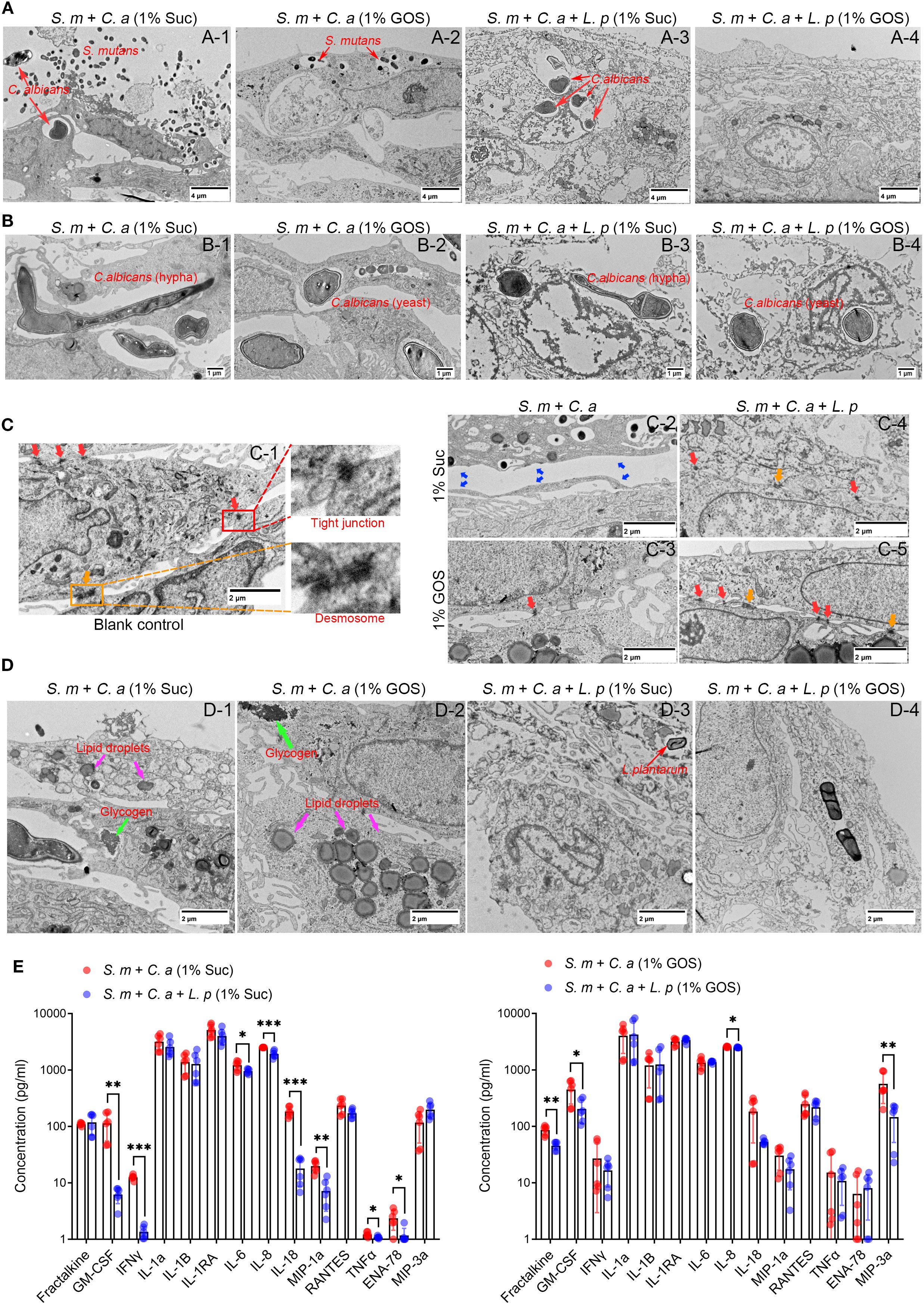 Section A shows electron microscopy images depicting Streptococcus mutans, Candida albicans, and Lactobacillus plantarum interactions under different conditions. Section B highlights Candida albicans in hyphal and yeast forms. Section C illustrates detailed views of cellular junctions, including tight junctions and desmosomes. Section D presents images showing lipid droplets, glycogen, and biofilm matrices. Section E contains bar graphs showing cytokine concentration levels for different microbial compositions.