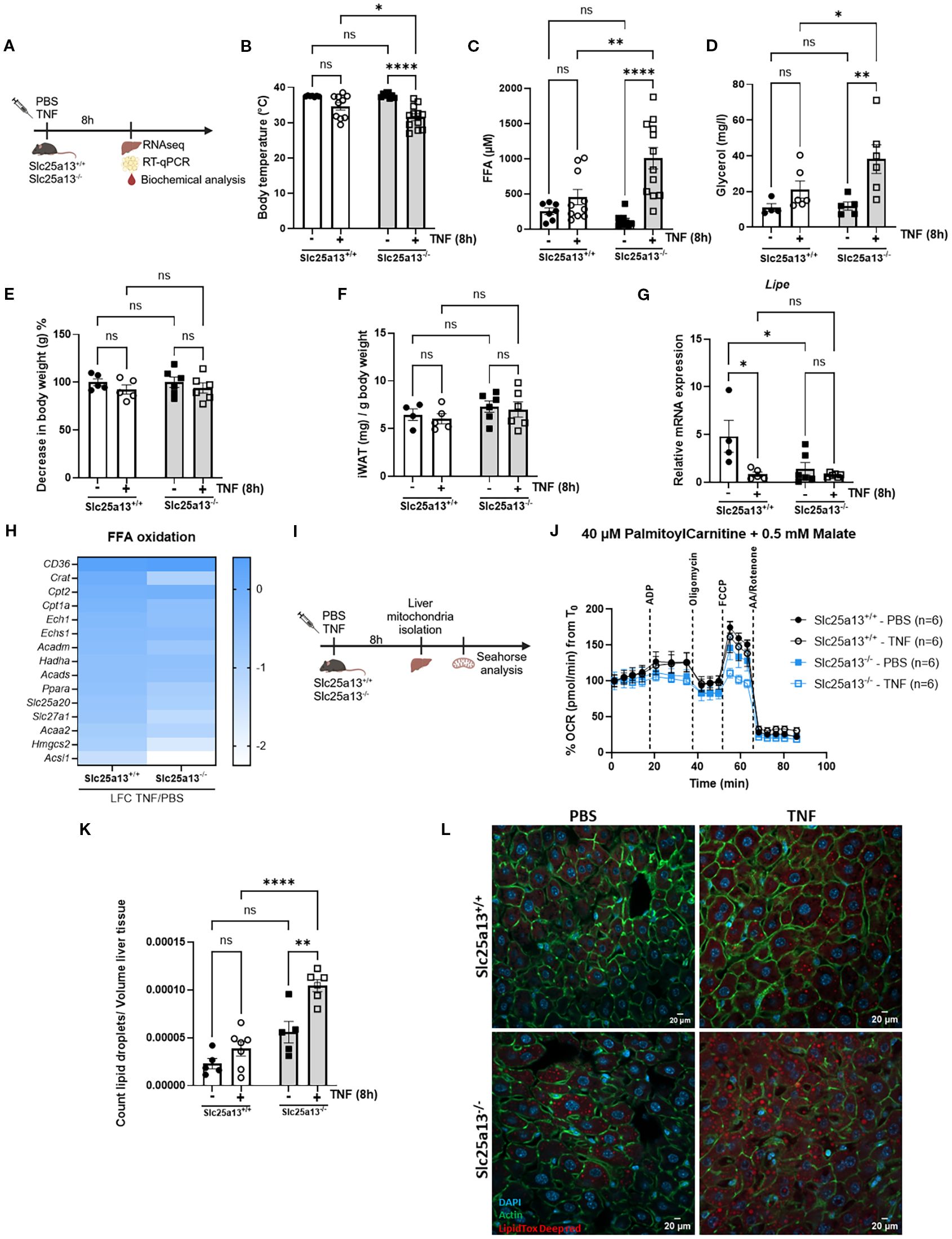 A series of panels illustrating a scientific study involving Slc25a13\+/+ and Slc25a13\−/− genotypes under PBS and TNF conditions. Panel A outlines the experimental setup. Panels B to G depict bar graphs presenting body temperature, free fatty acids (FFA), glycerol, and various biomarkers with statistical significance indicated. Panel H is a heatmap of FFA oxidation data. Panel I describes the mitochondrial isolation process. Panel J shows a line graph of oxygen consumption rate over time. Panel K displays a graph of lipid droplet count in liver tissue. Panel L contains microscopy images showing stained liver samples under different conditions.