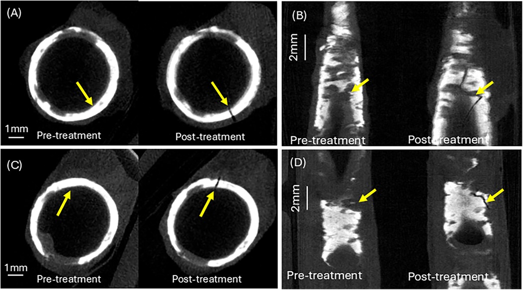 CT scans in four panels comparing pre-treatment and post-treatment conditions. Panels A and C display cross-sectional views showing circular structures with noticeable changes, marked by yellow arrows. Panels B and D present longitudinal views of bone or similar material with visible changes post-treatment, also indicated by yellow arrows. Panels A and C feature 1 millimeter scale bars, while panels B and D feature 2 millimeter scale bars.