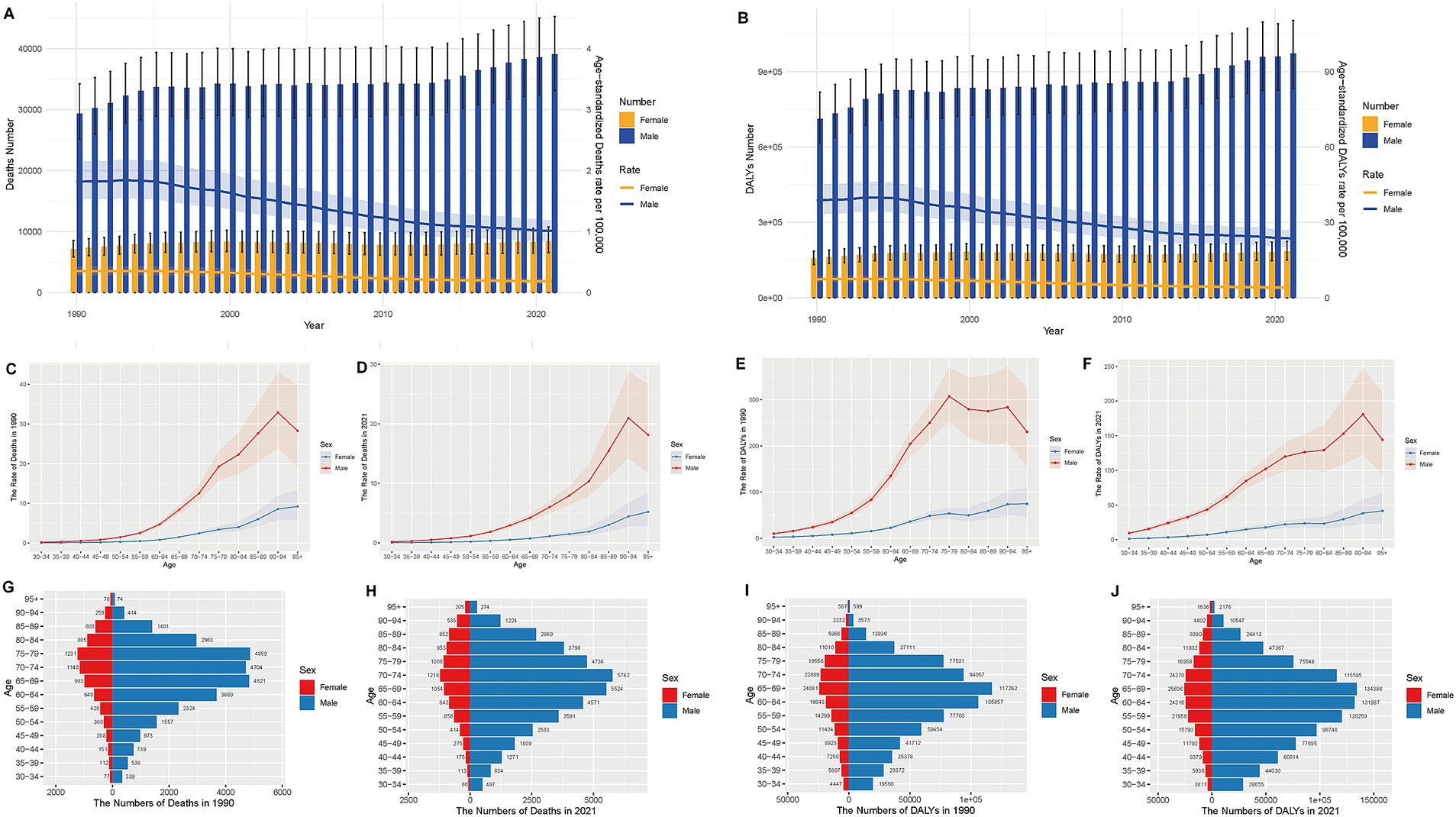 Chart panels A and B depict death and DALYs numbers and rates by gender from 1990 to 2021. Panels C to F show death and DALY rates by age and gender for 1990 and 2021. Panels G to J are bar charts showing numbers of deaths and DALYs by age and gender for 1990 and 2021.