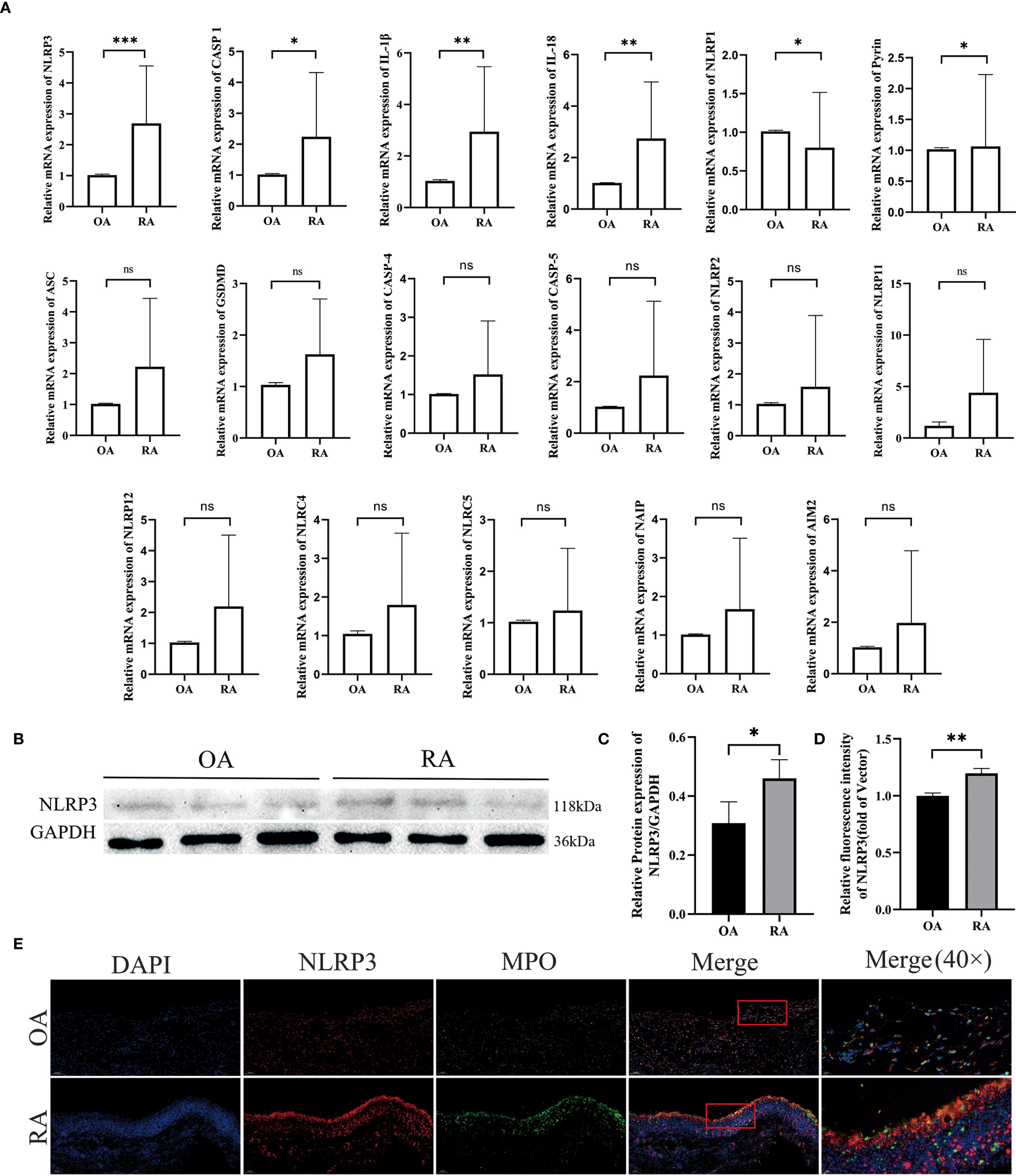 Bar graphs and Western blot images comparing the expression levels of various mRNA and proteins in osteoarthritis (OA) and rheumatoid arthritis (RA) samples. Graph A shows significant differences (indicated by asterisks) in NLRP3, CASP1, IL1β, IL18, and NLRP1 expression between OA and RA. Graphs B, C, and D show relative protein expression and significance levels. Panel E displays DAPI, NLRP3, and MPO staining in OA and RA samples, with merged images highlighting differences in expression patterns.