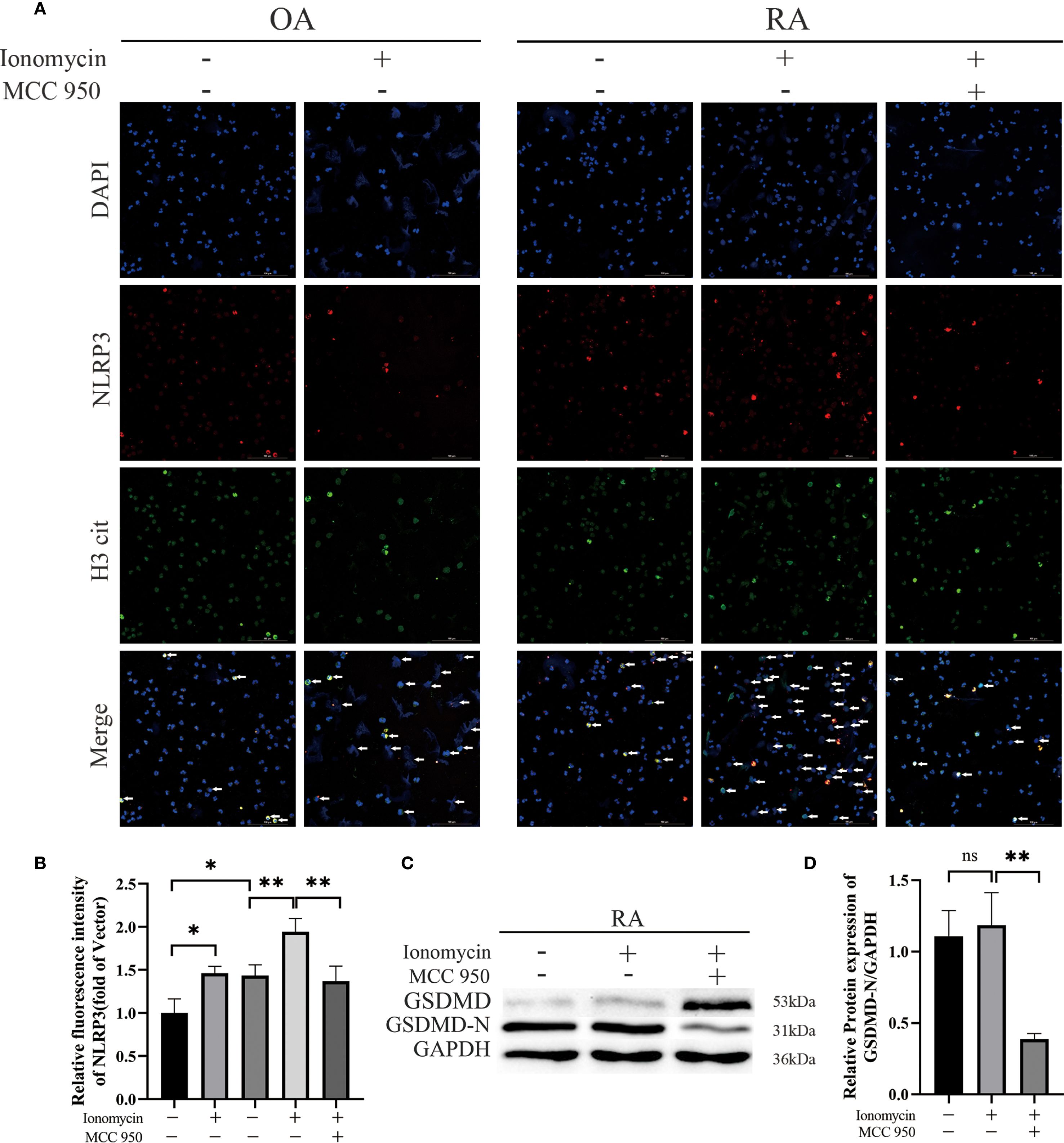 Inhibition of NLRP3 ameliorates collagen-induced arthritis (CIA) in mice. MCC950 was administered intraperitoneally to each mouse at 50 mg/kg every other day. (A) Representative images of hind paws from each group on day 40 of treatment. Arthritis severity was graded on a 0–4 scale. Data (mean ± SD, n = 6) compare the control, CIA, and MCC950-treated groups. (B) Micro-computed-tomography (micro-CT) cross-sections of hind-ankle joints after 40 days of treatment to evaluate bone destruction. (C) Arthritis scores for the mice. (D) HE and TB staining, along with histological scoring, were performed on ankle-joint sections collected on day 40 to evaluate synovial pathology and bone erosion/destruction.